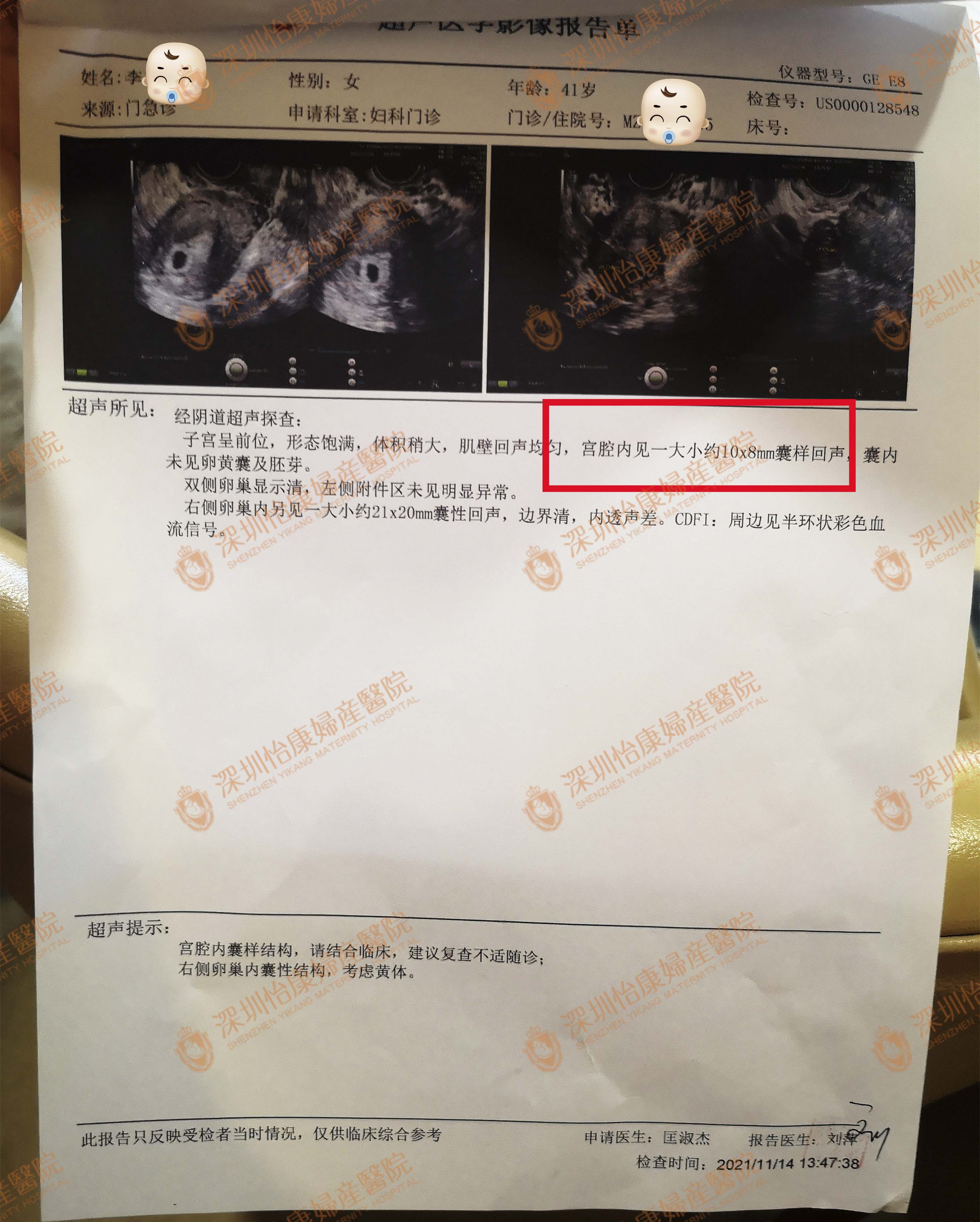 输卵管被结扎成七段复通手术难度高 选择怡康术后喜得儿子又怀二胎报喜(图3)