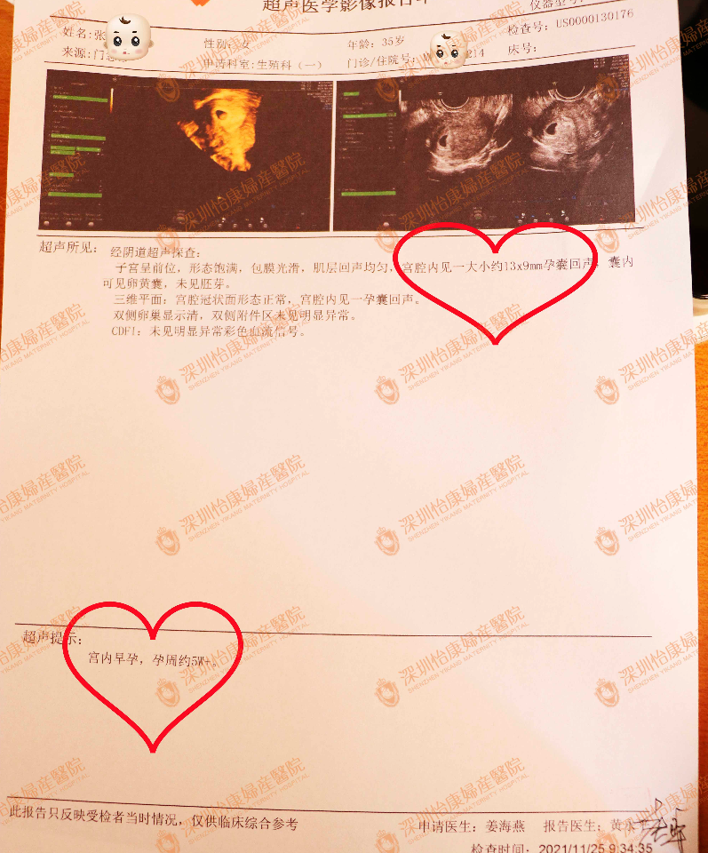 2个月快孕报喜(图2)