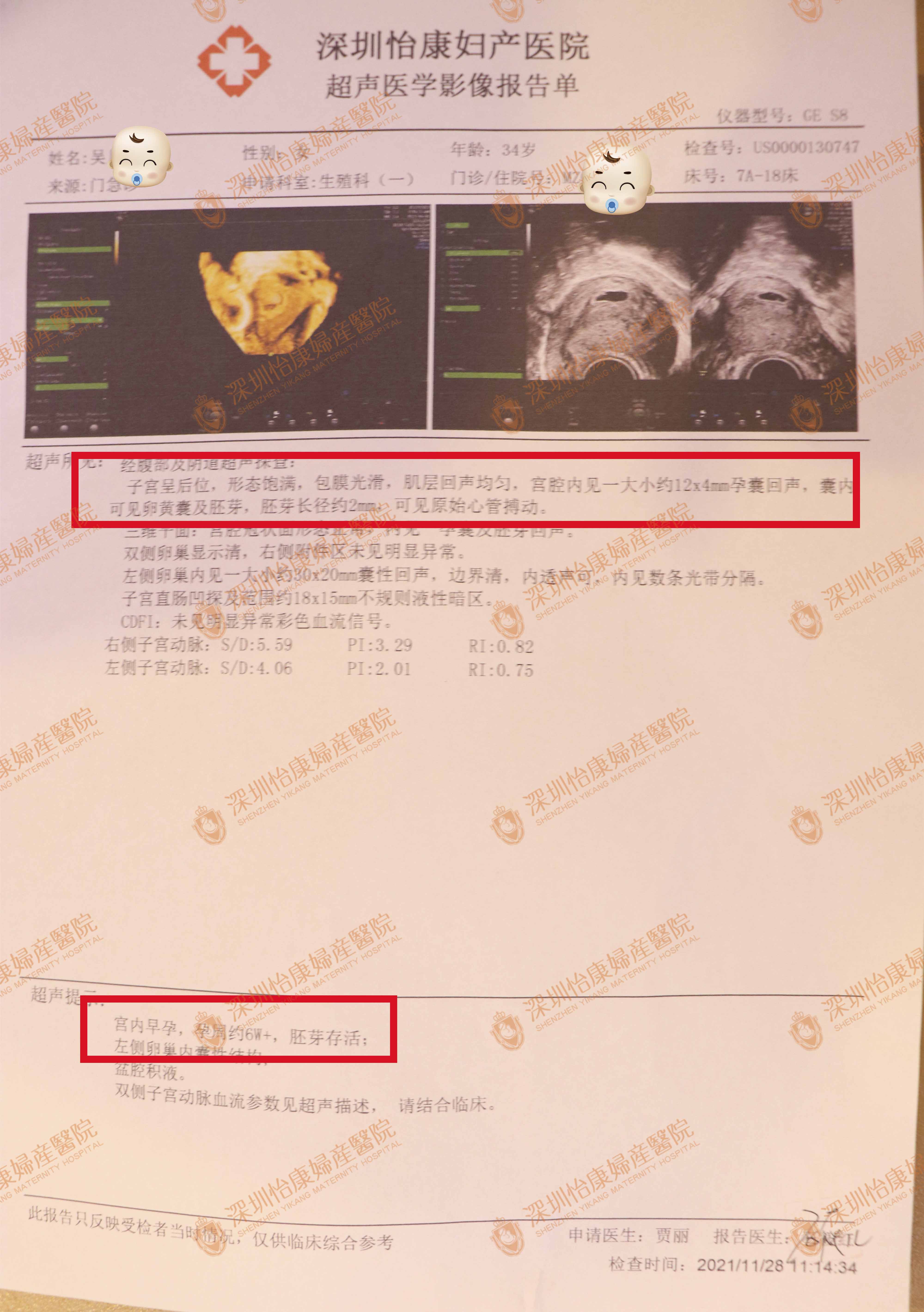 病情复杂怀孕难，找到怡康2个月快孕(图2)