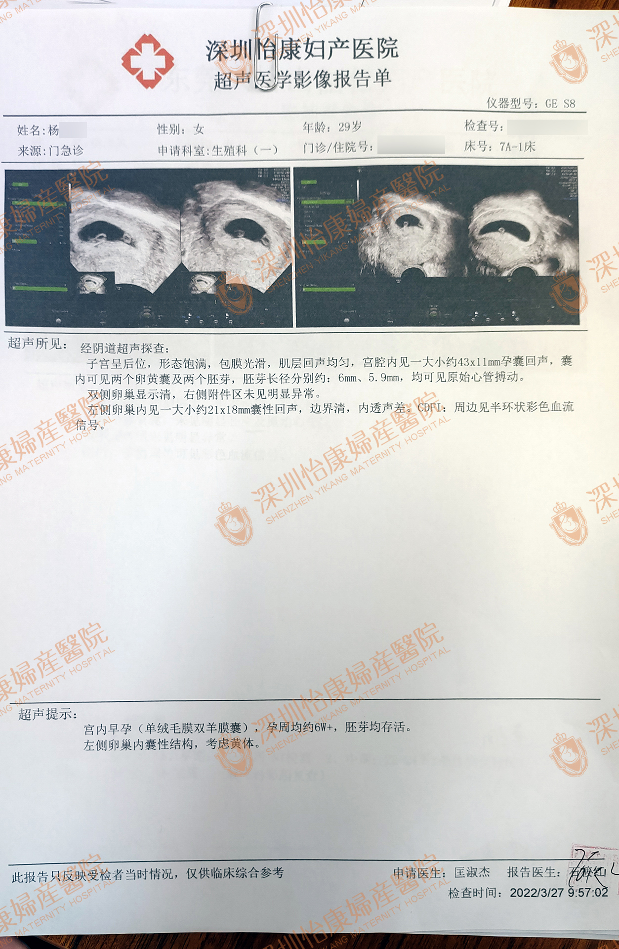 婚后2年不孕羡慕别人家小朋友 来怡康专家助孕幸福降临怀双胎(图3)