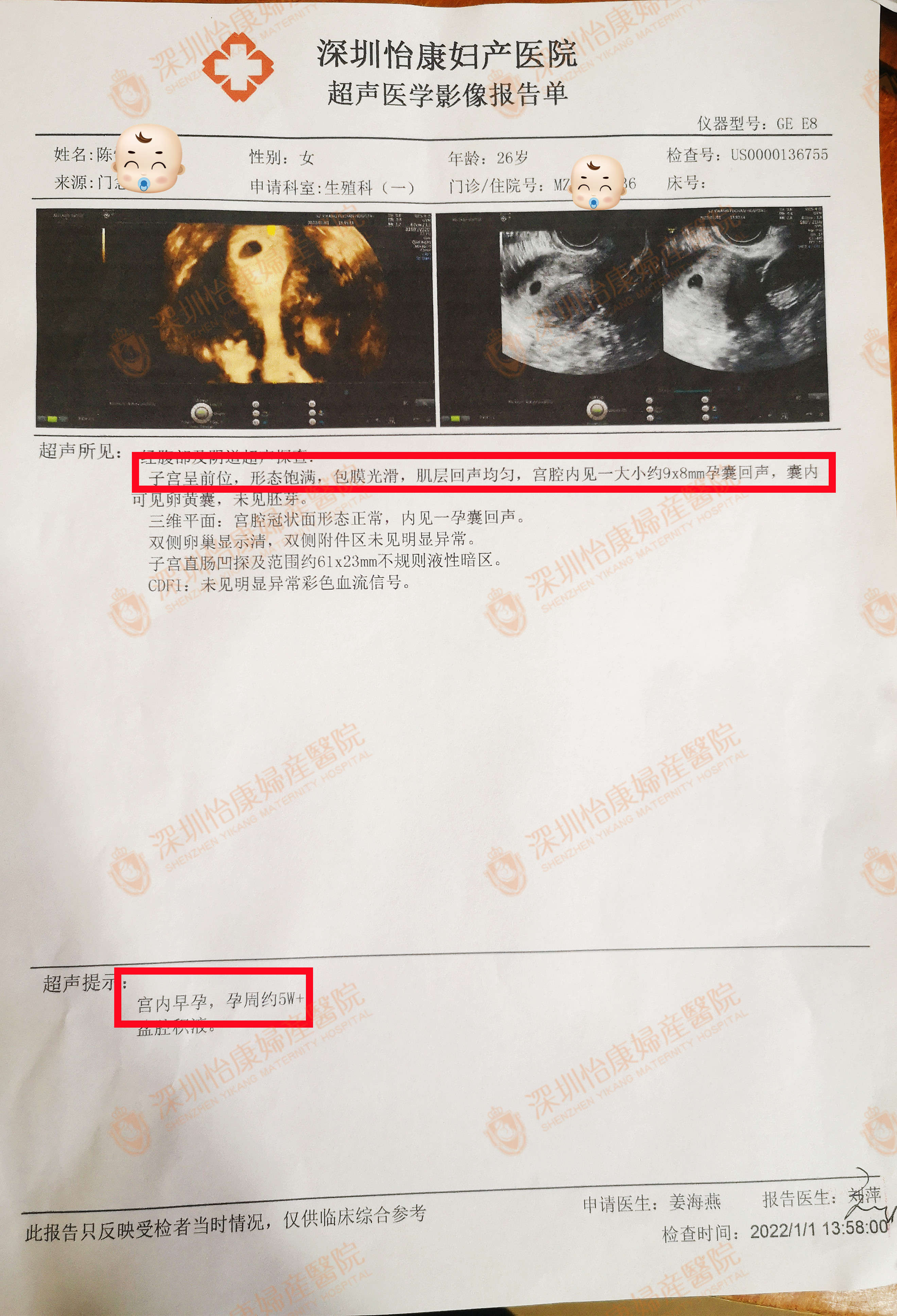 月经不规则10年 选择怡康1个月快孕
