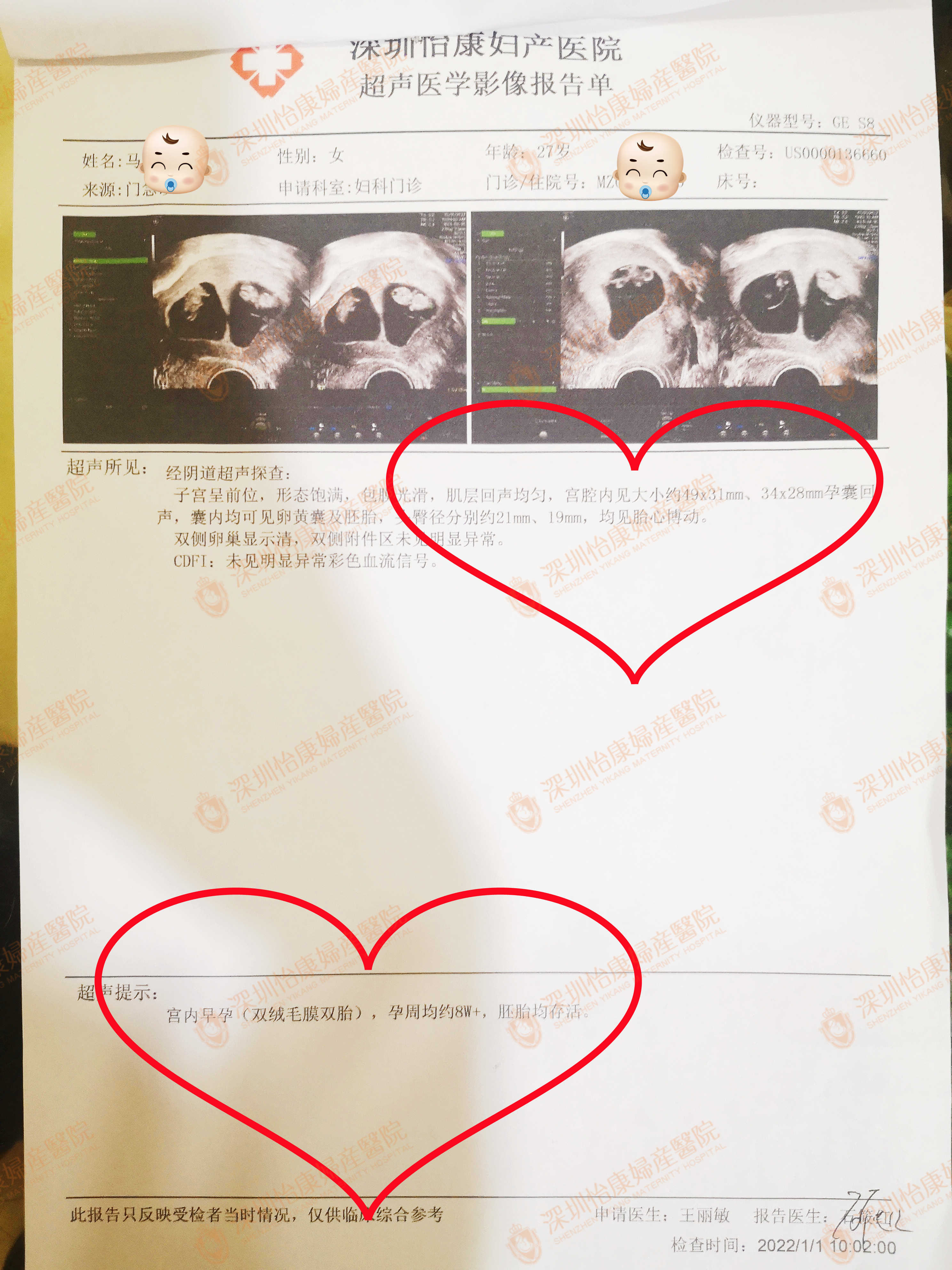 胎停两次清宫术后备孕半年未怀孕 怡康查明病因夫妻同治喜怀双胞胎