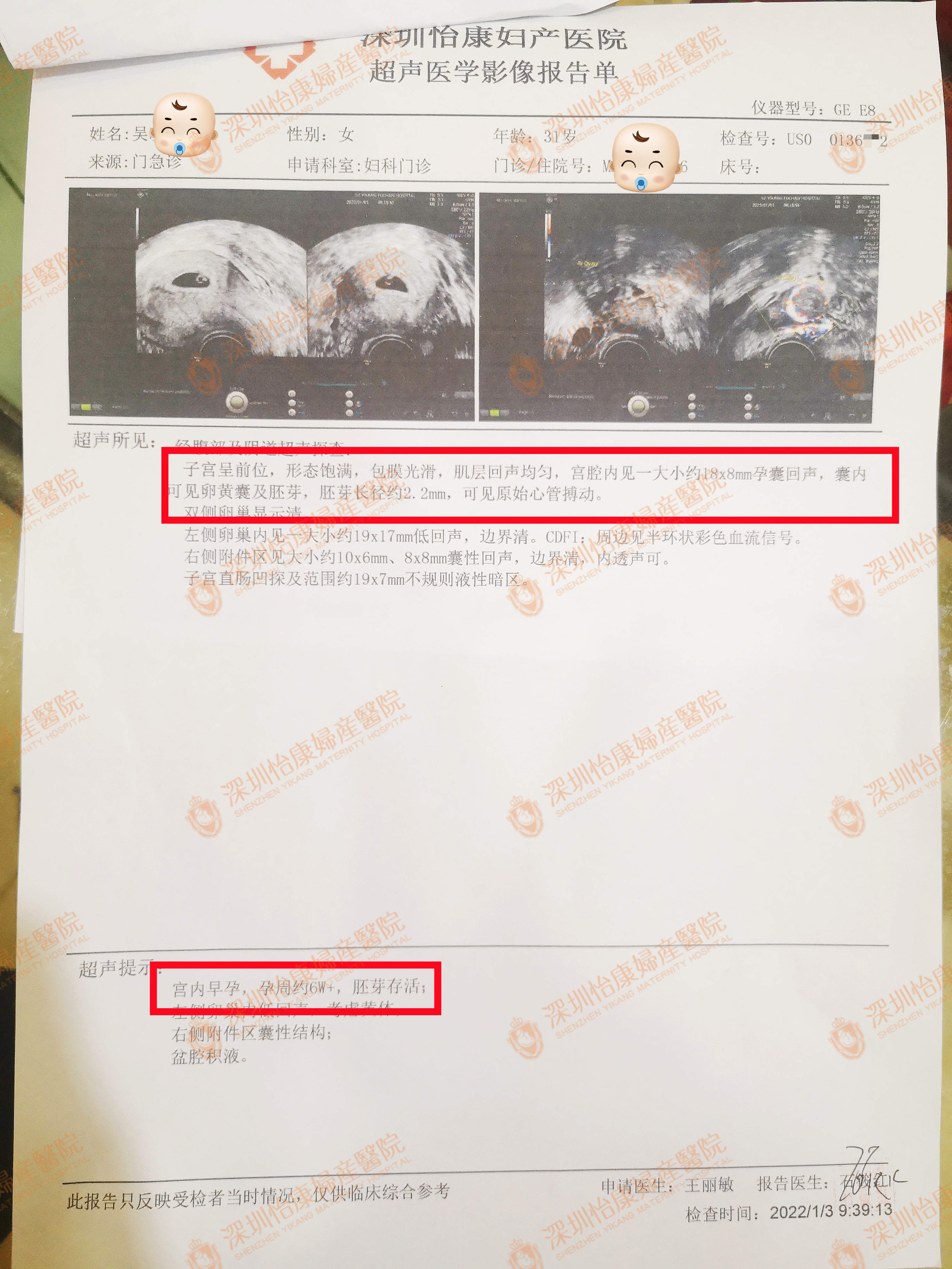 备孕5年未孕病情复杂考虑做试管 选怡康科学助孕夫妻同治自然好孕