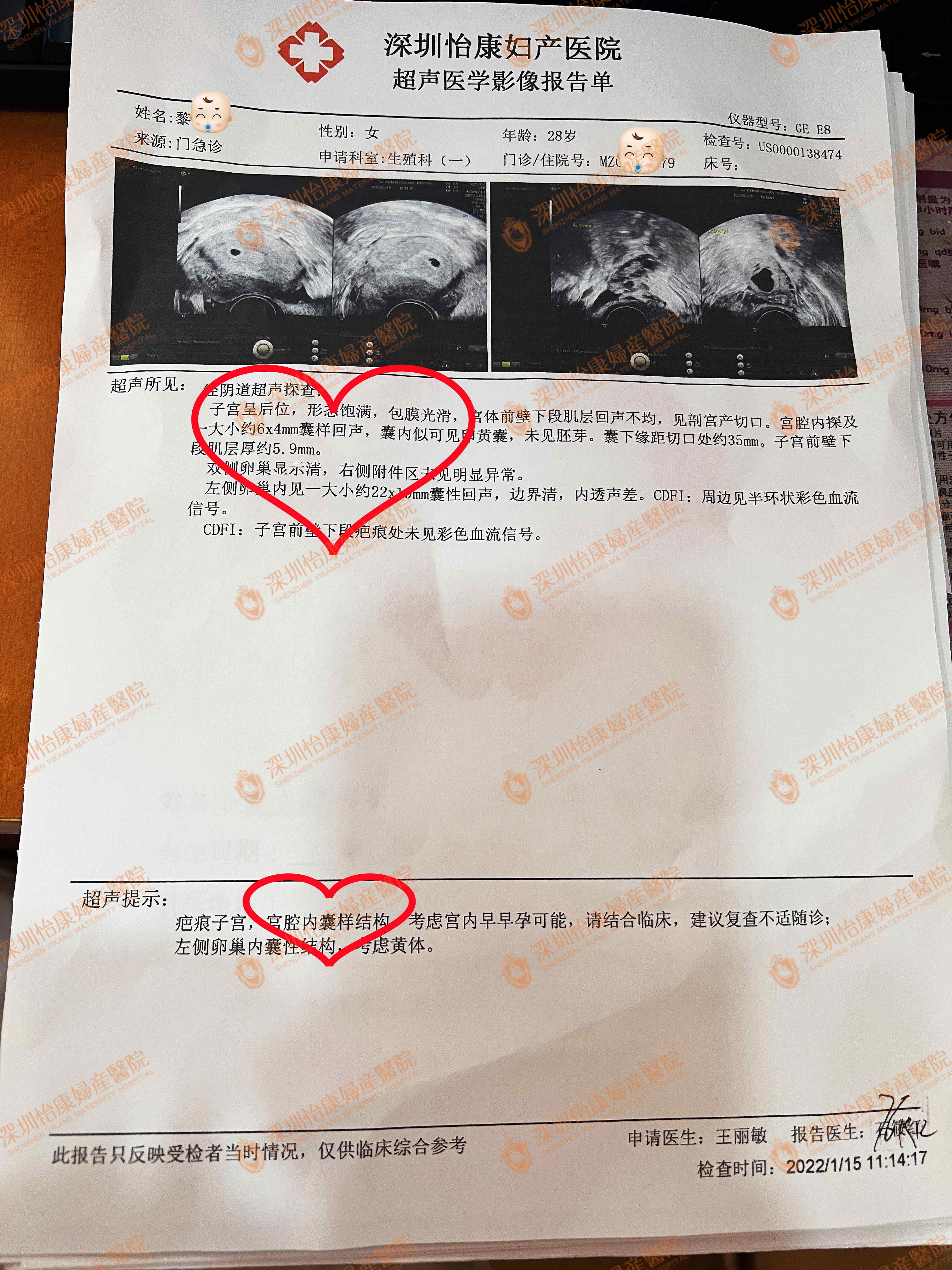 1个月快孕报喜，科学助孕怡康速度！