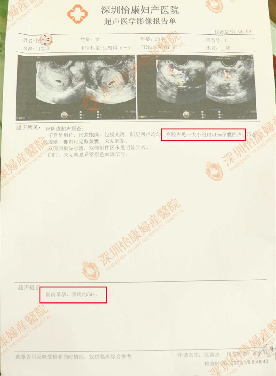 外院求孕未果来怡康一试 结婚纪念日当天获得喜讯