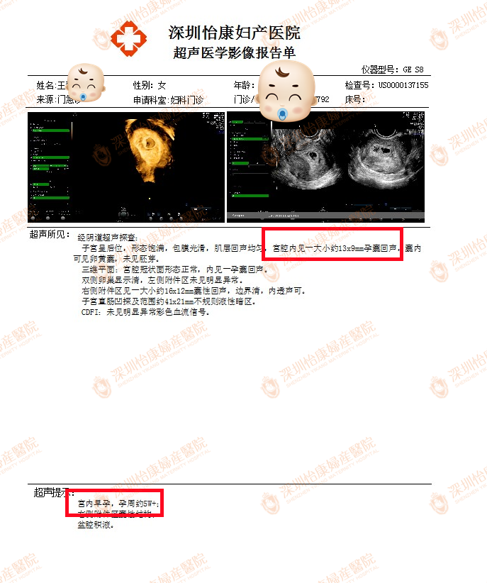 怡康助孕3个月快孕报喜