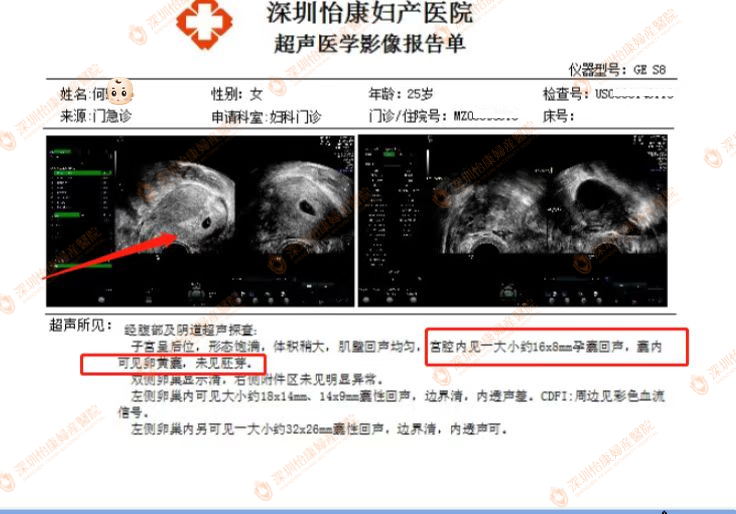 来怡康找对专家努力坚持 药物调理后成为温柔宝妈