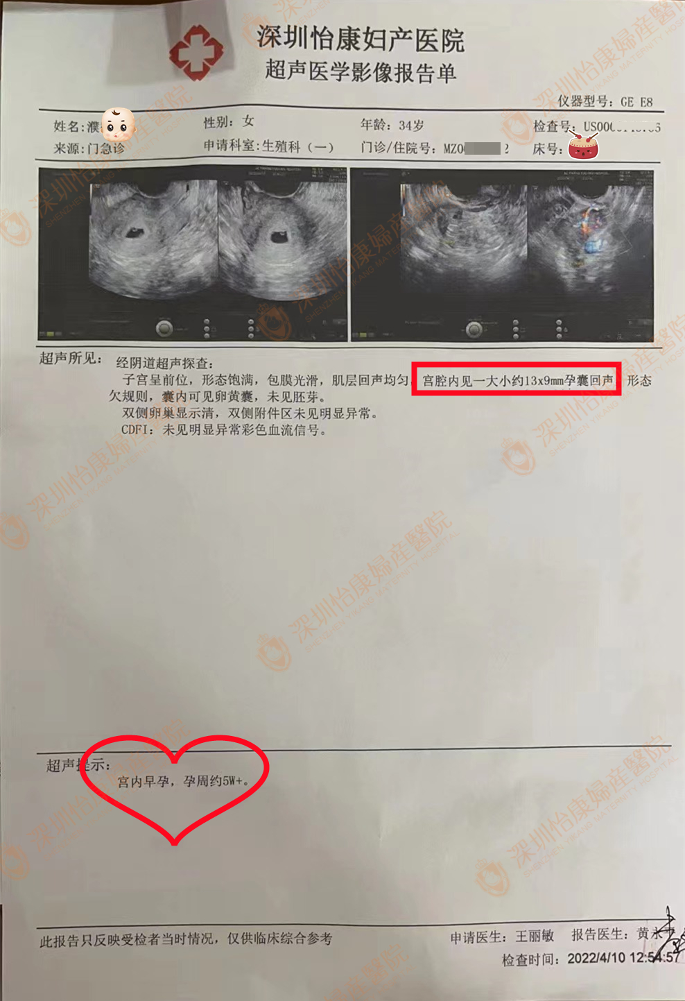 再婚后备孕 怡康助她圆梦