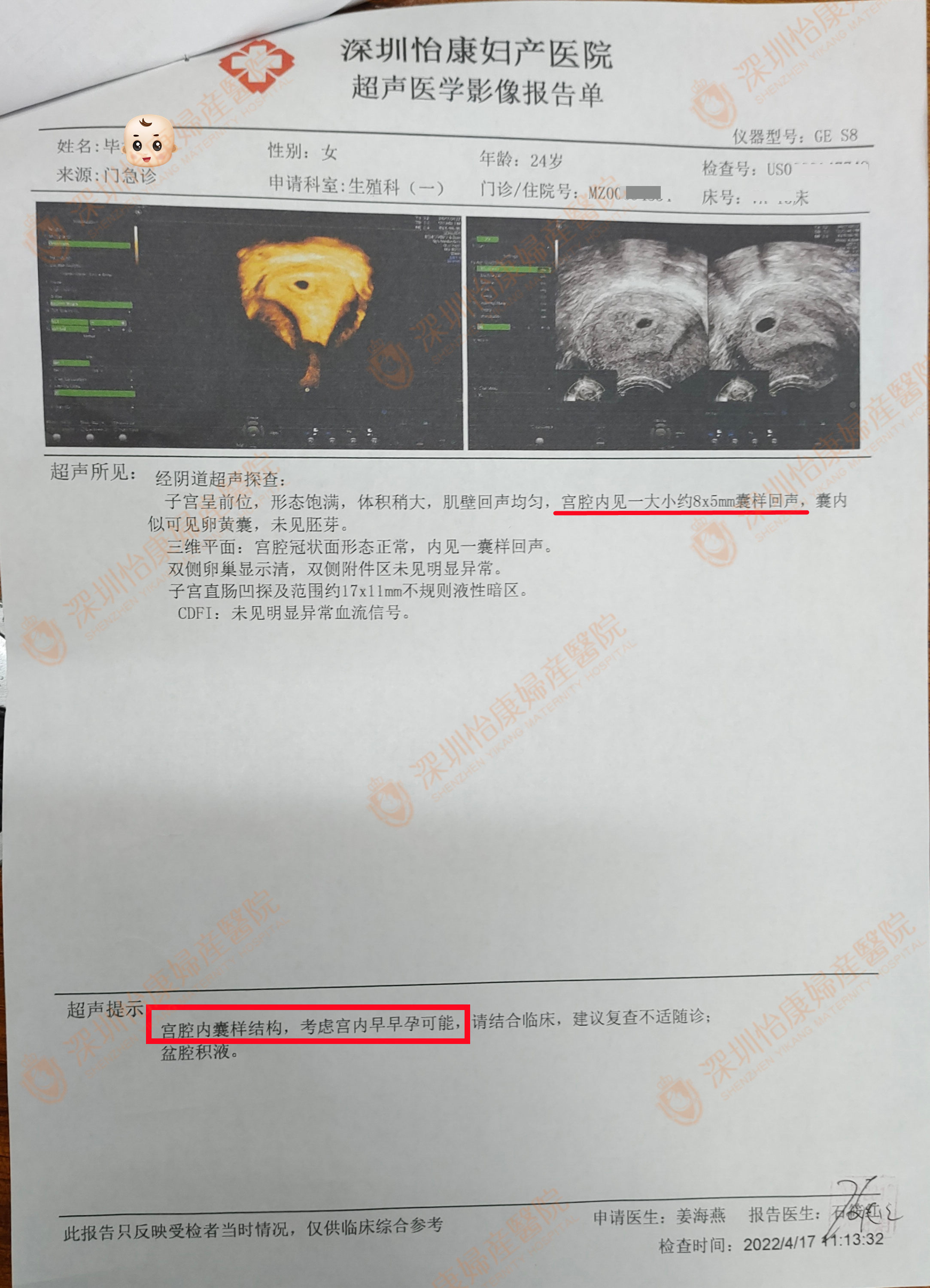 婚后3年多未孕独生子家庭很着急 来怡康查准病因促排1次愁容转喜