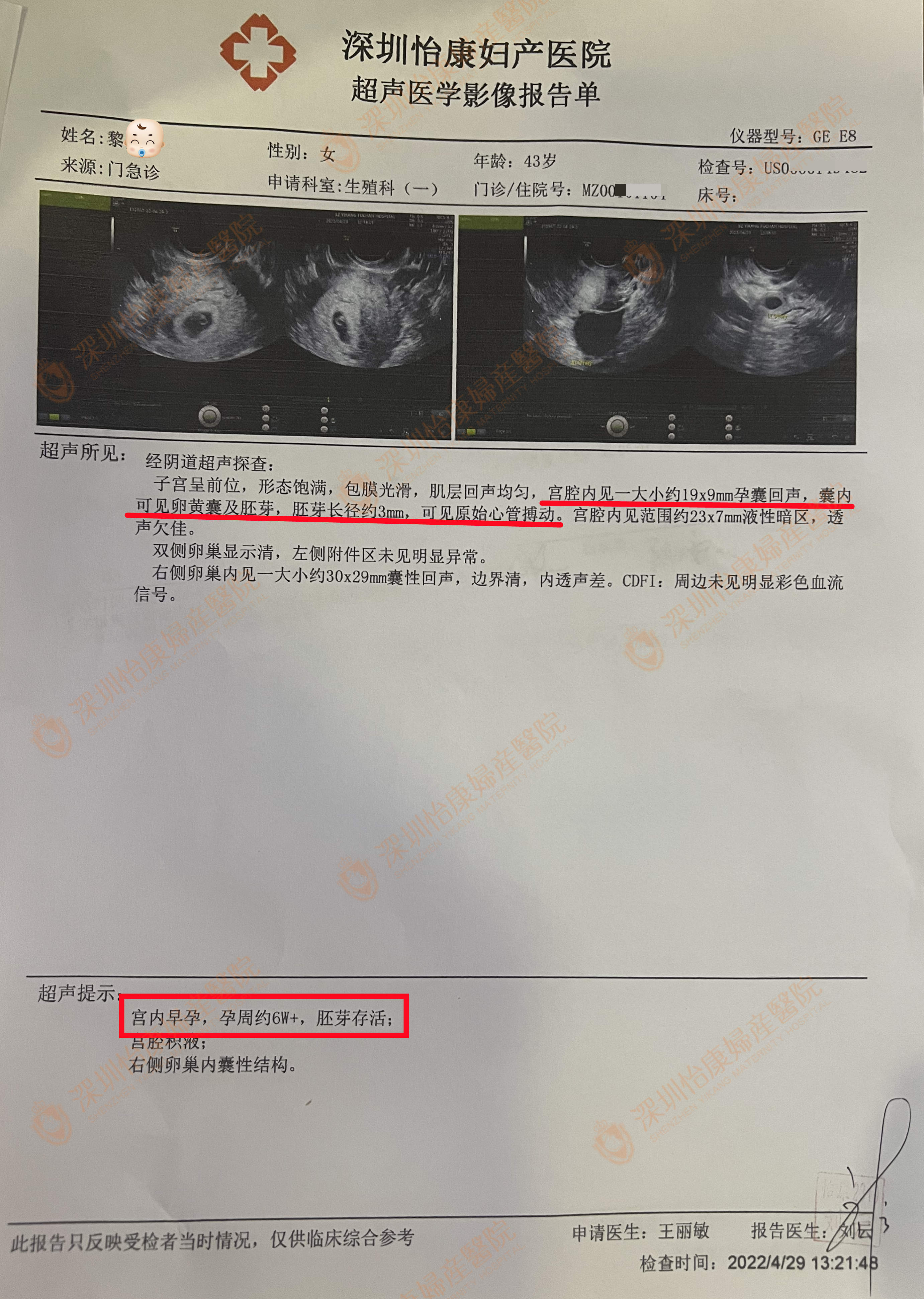 43岁高龄 来怡康2个月快孕