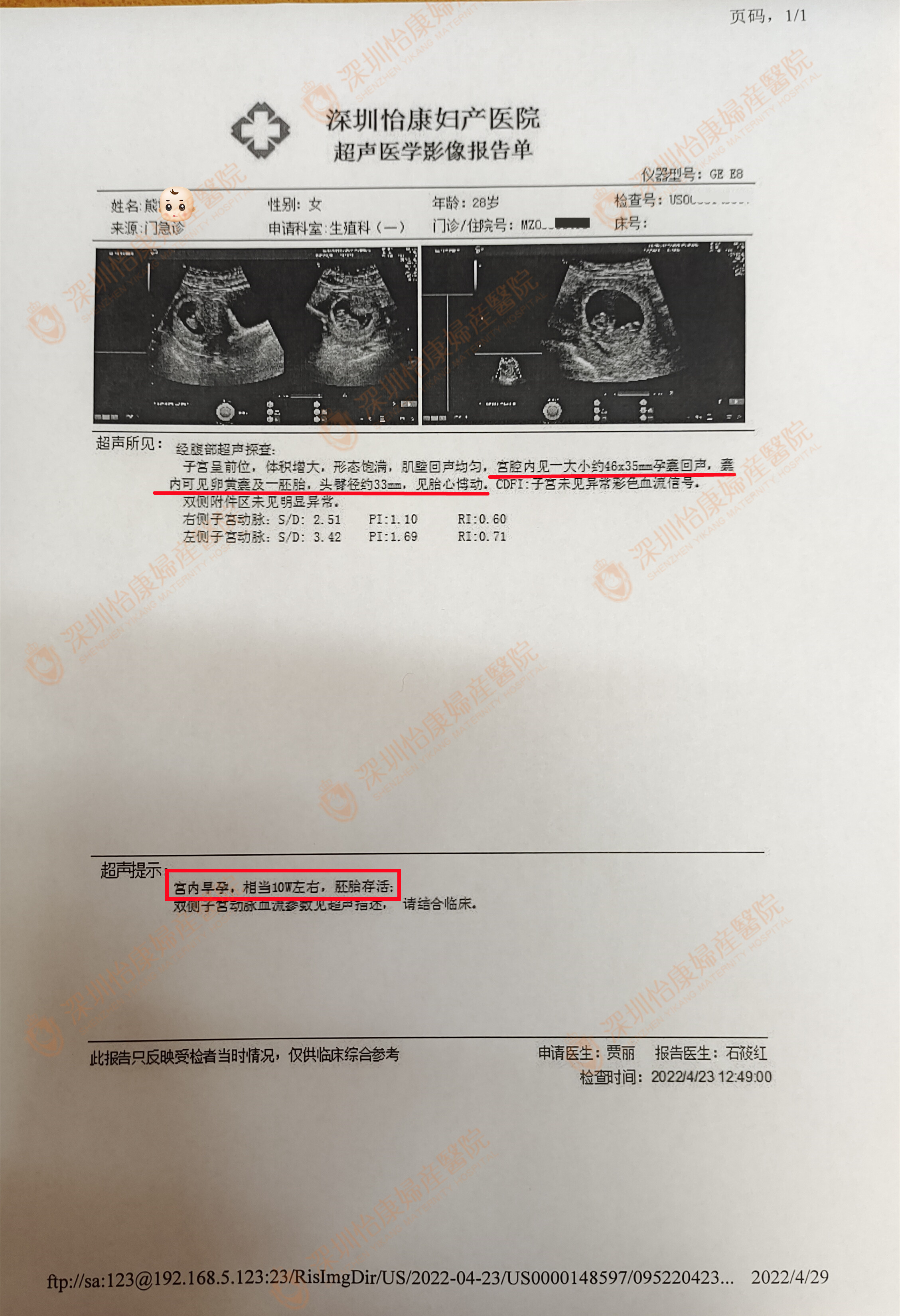外院孕检结果不好医生建议放弃 不甘心来怡康坚持调理保胎成功