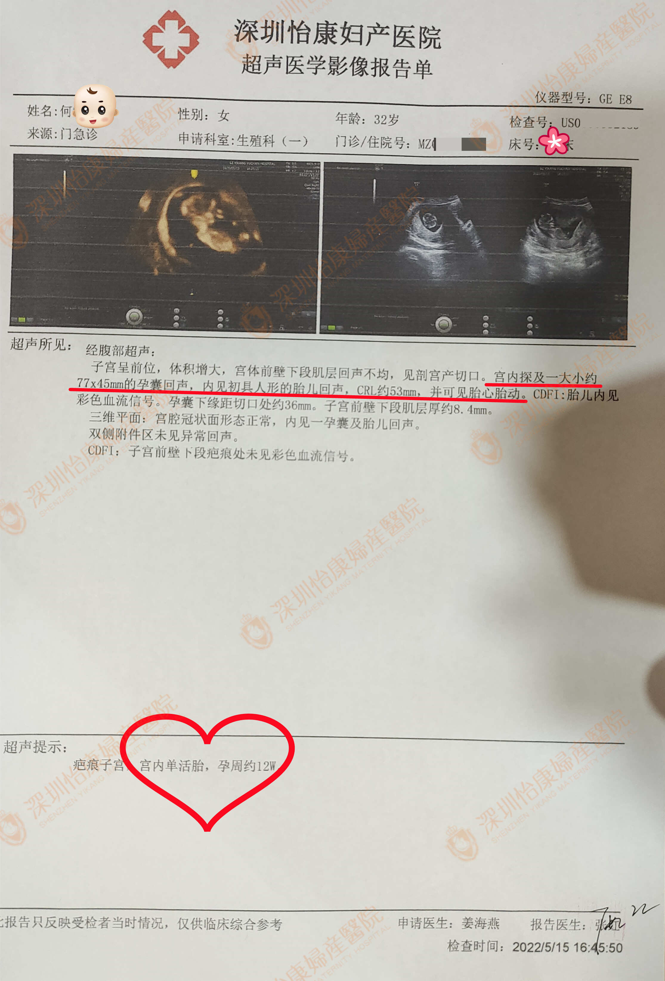 备孕三年无果引起家人误会 慕名而来遇到专家喜获快孕