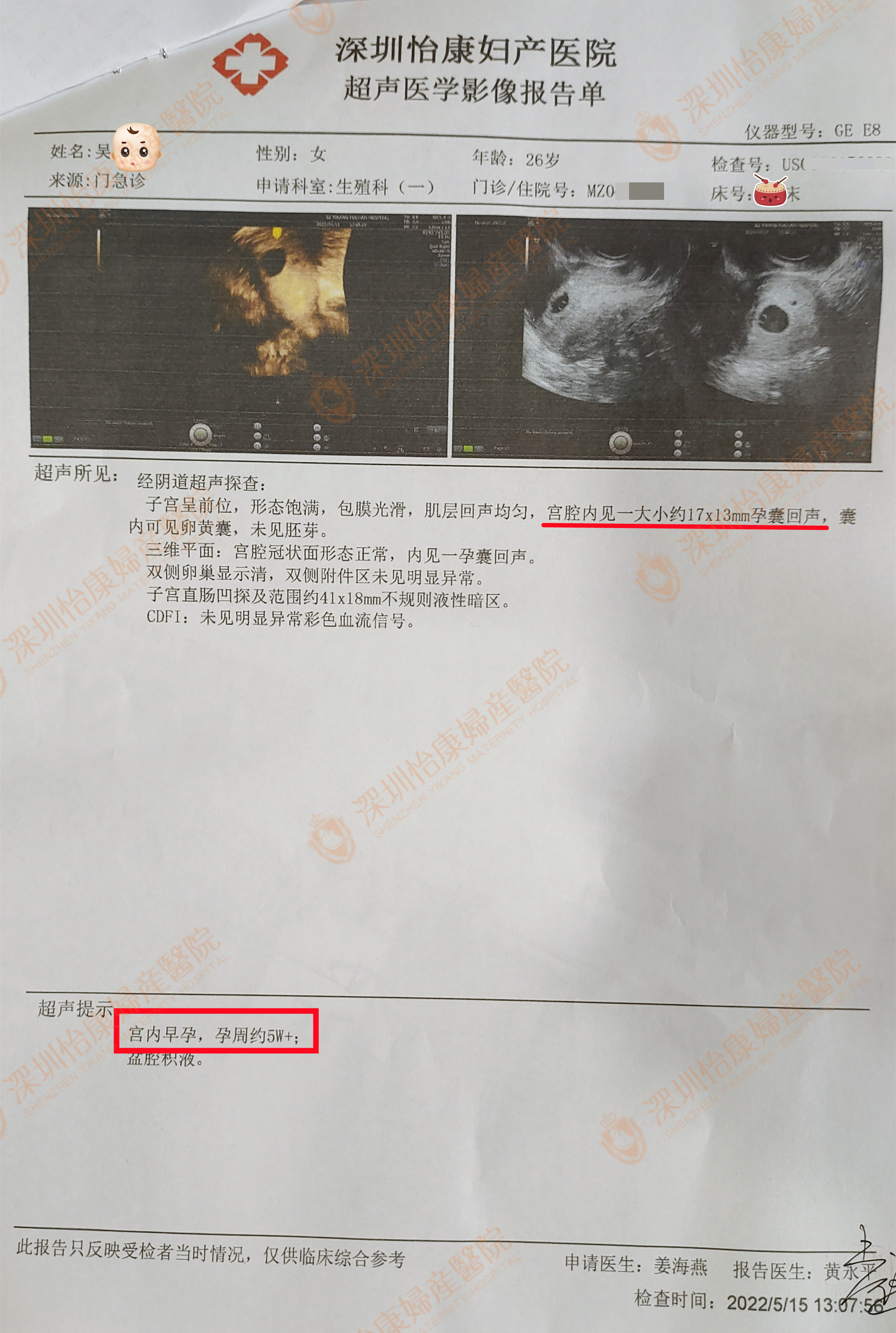 单亲家庭长大的她求孕受阻 怡康助力她添子添福添温暖