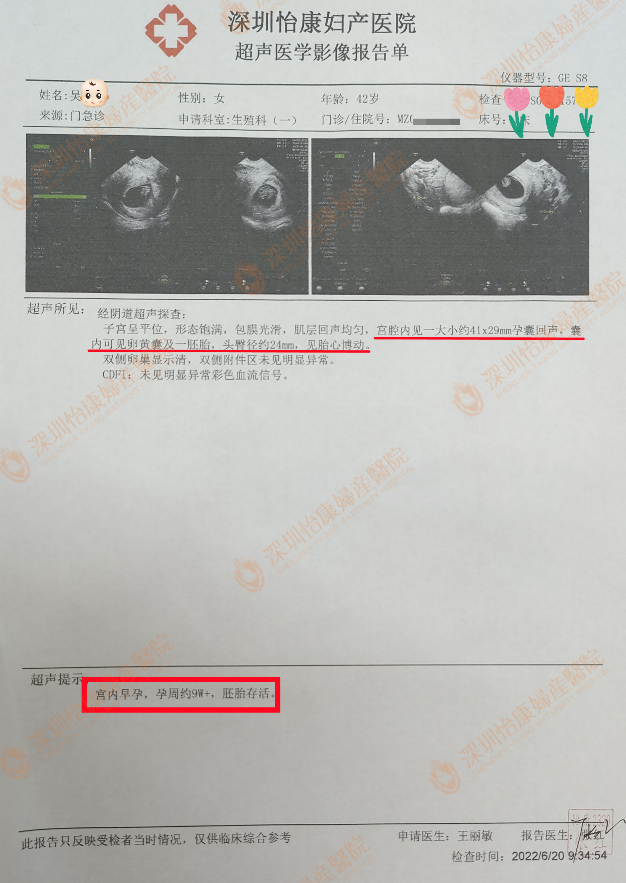 结扎10年来怡康要三胎宝宝  配合专家诊治高龄迎孕9周+