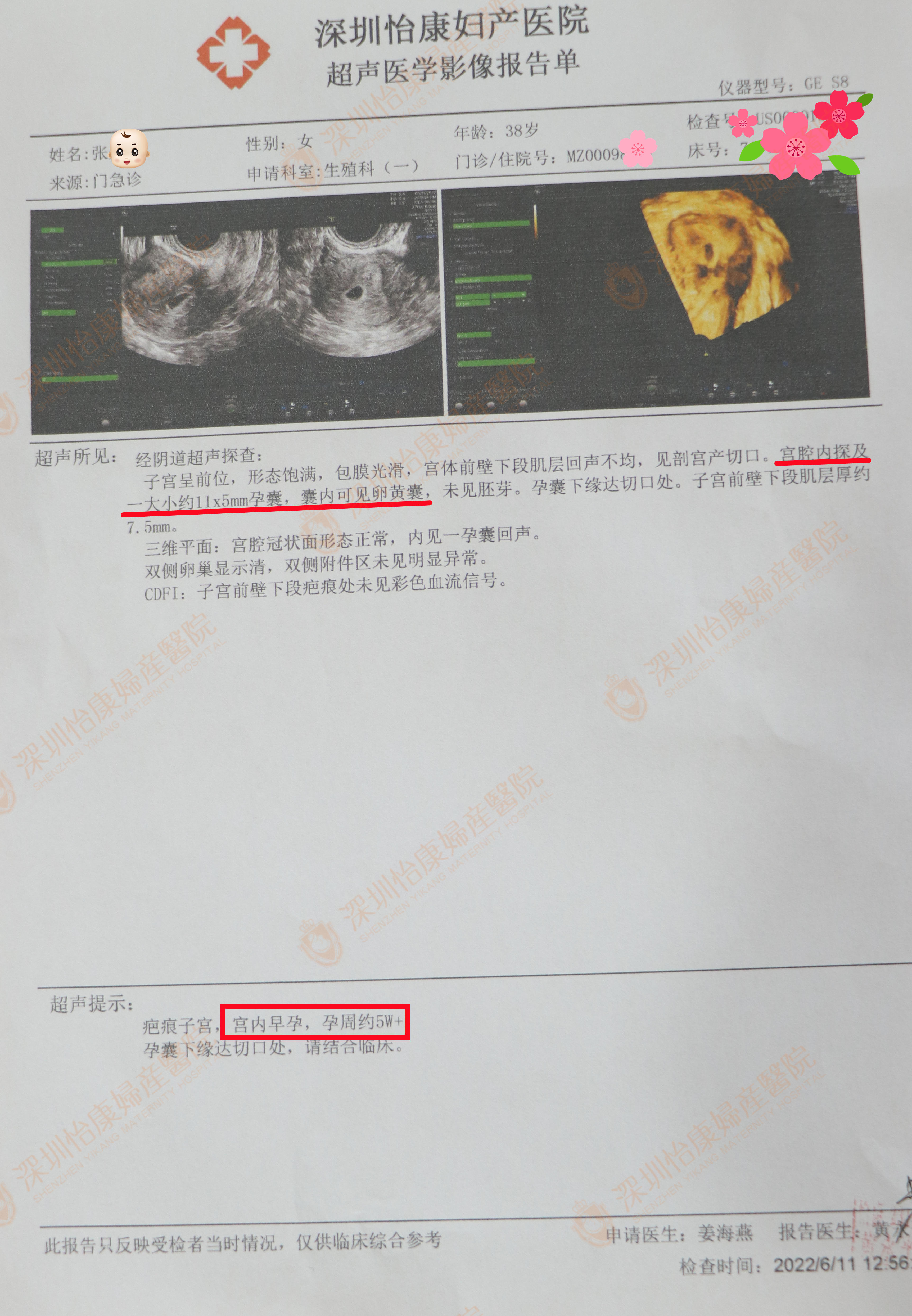 外院告知怀孕无望建议试管助孕  结缘怡康良医身心同治喜获快孕