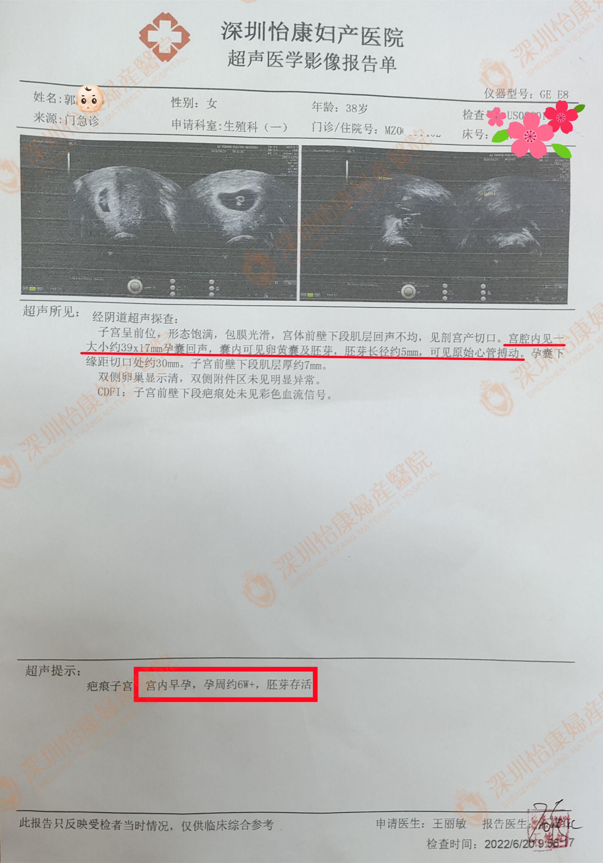 外院治疗无效朋友介绍来怡康  专家循序诊治患者配合获好孕