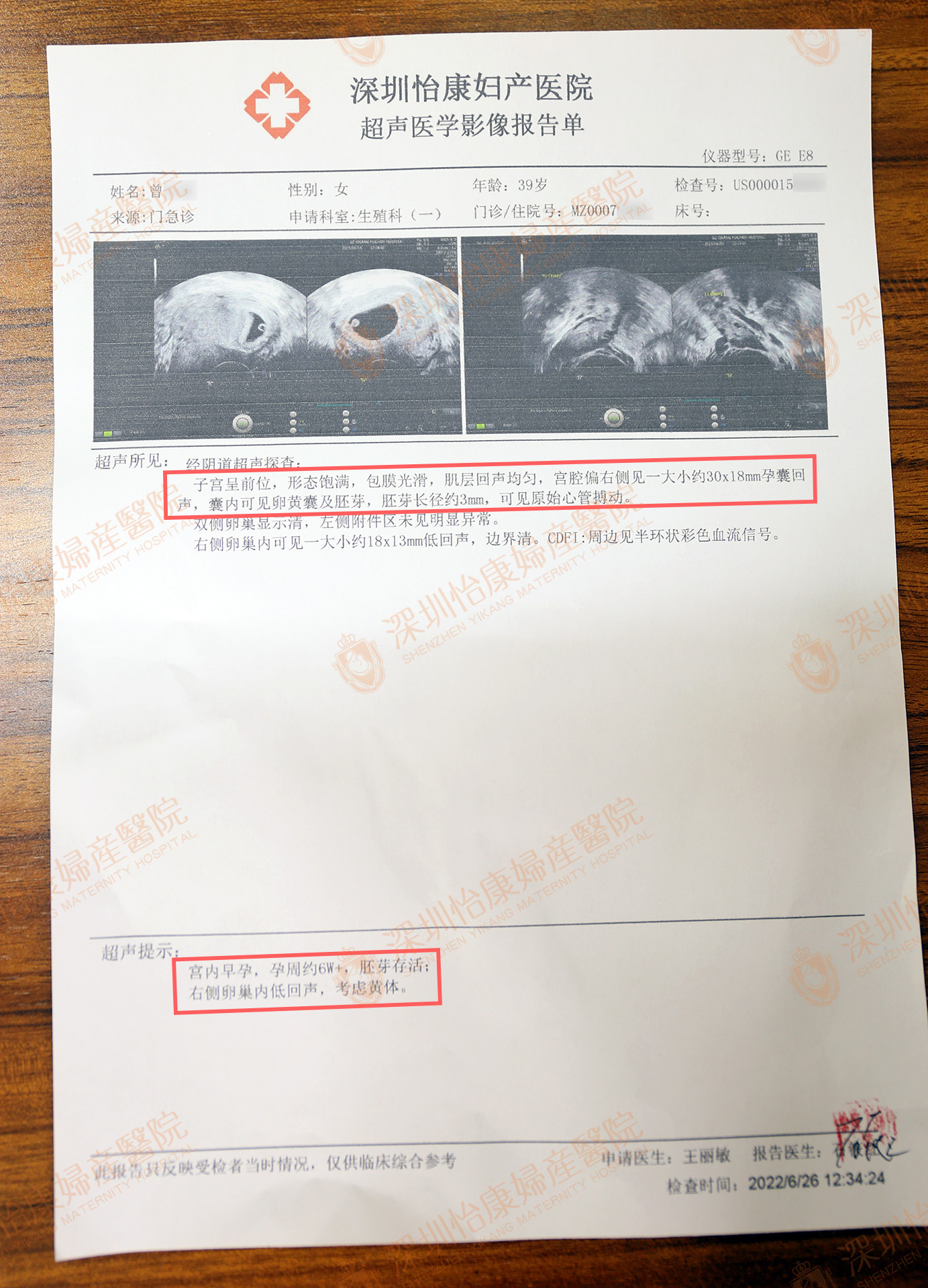 为爱情高龄备孕第三胎  扫除障碍怡康助她圆梦