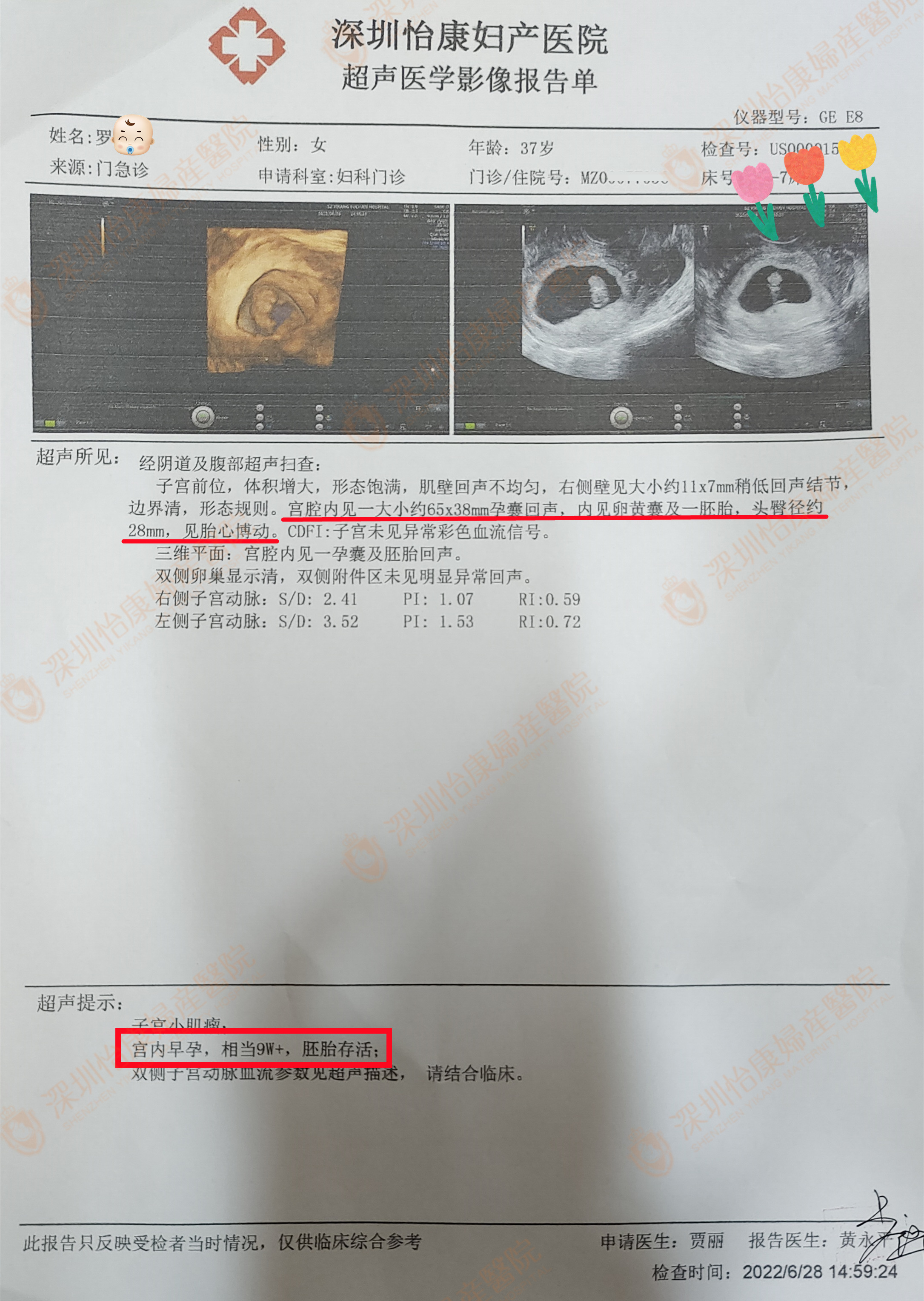 网络上了解到怡康复通术做得好 慕名前来专家相助得好孕展笑颜