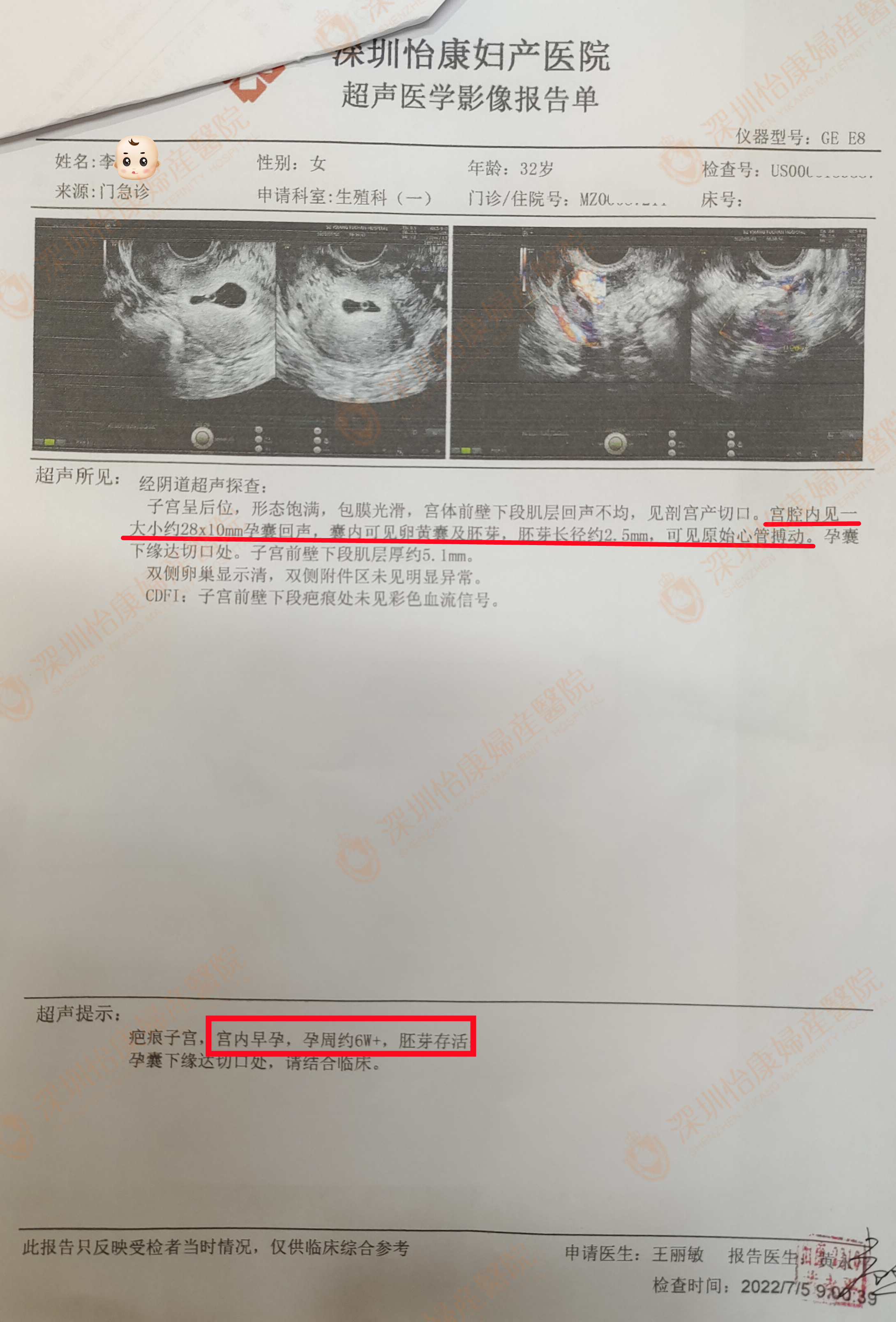 因胎停来保胎主任苦口婆心劝解 为她线上指导术后再怀有效保胎