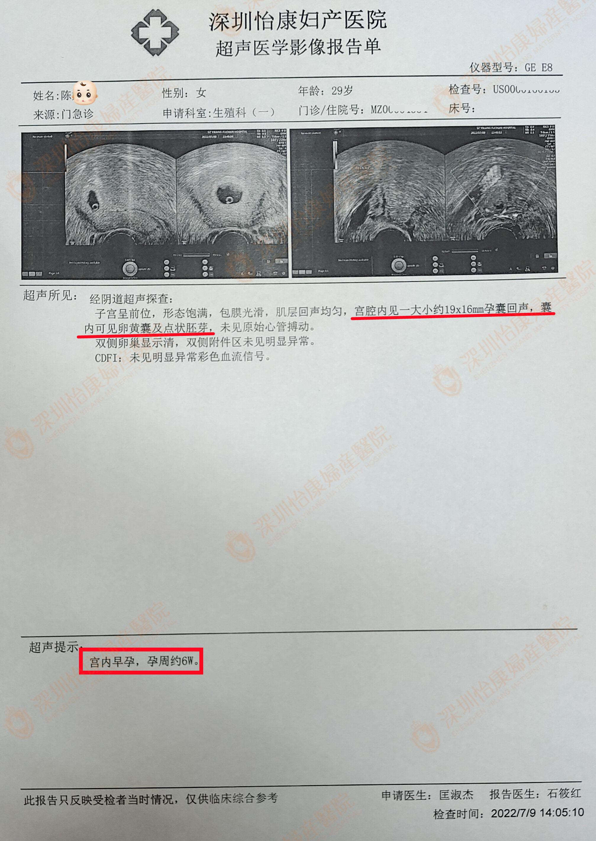 去年因妇科病找到怡康 今年看了一下就怀孕了