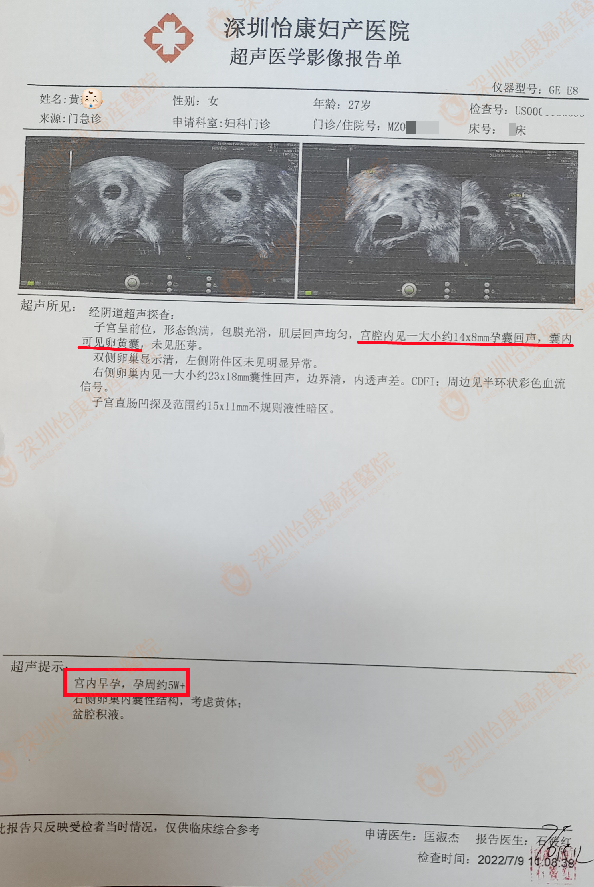 备孕一年多未果来怡康 专家助淡定姑娘迎快孕