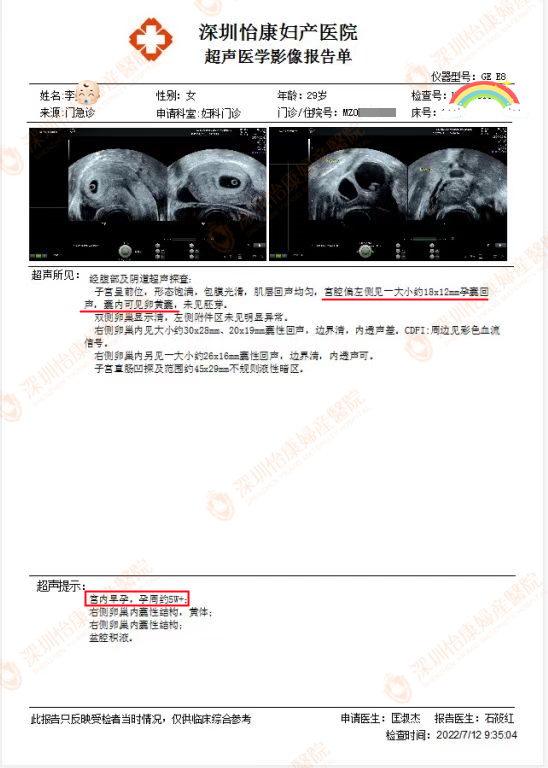 外院多次检查治疗无效 朋友介绍来怡康喜怀孕