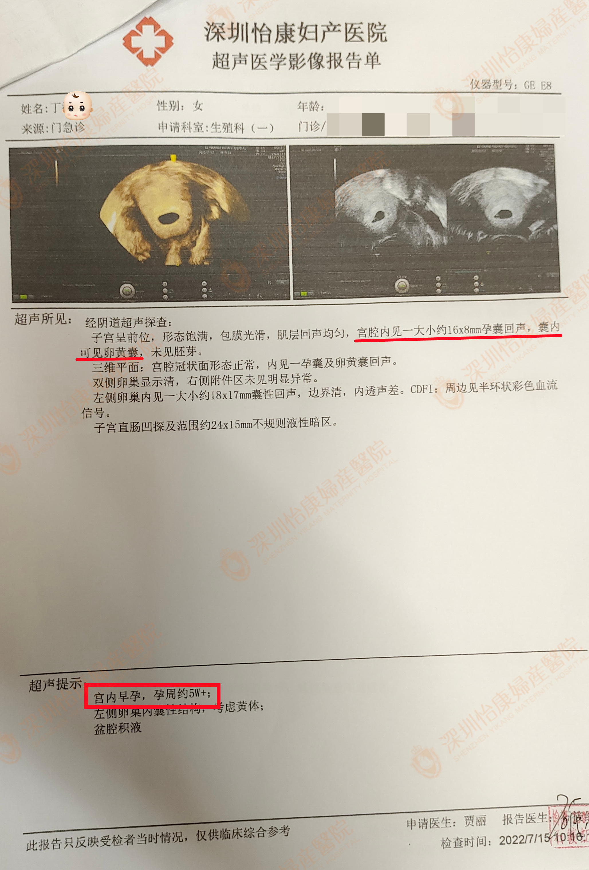 备孕未果一家人很着急 怡康帮助提前达成目标 