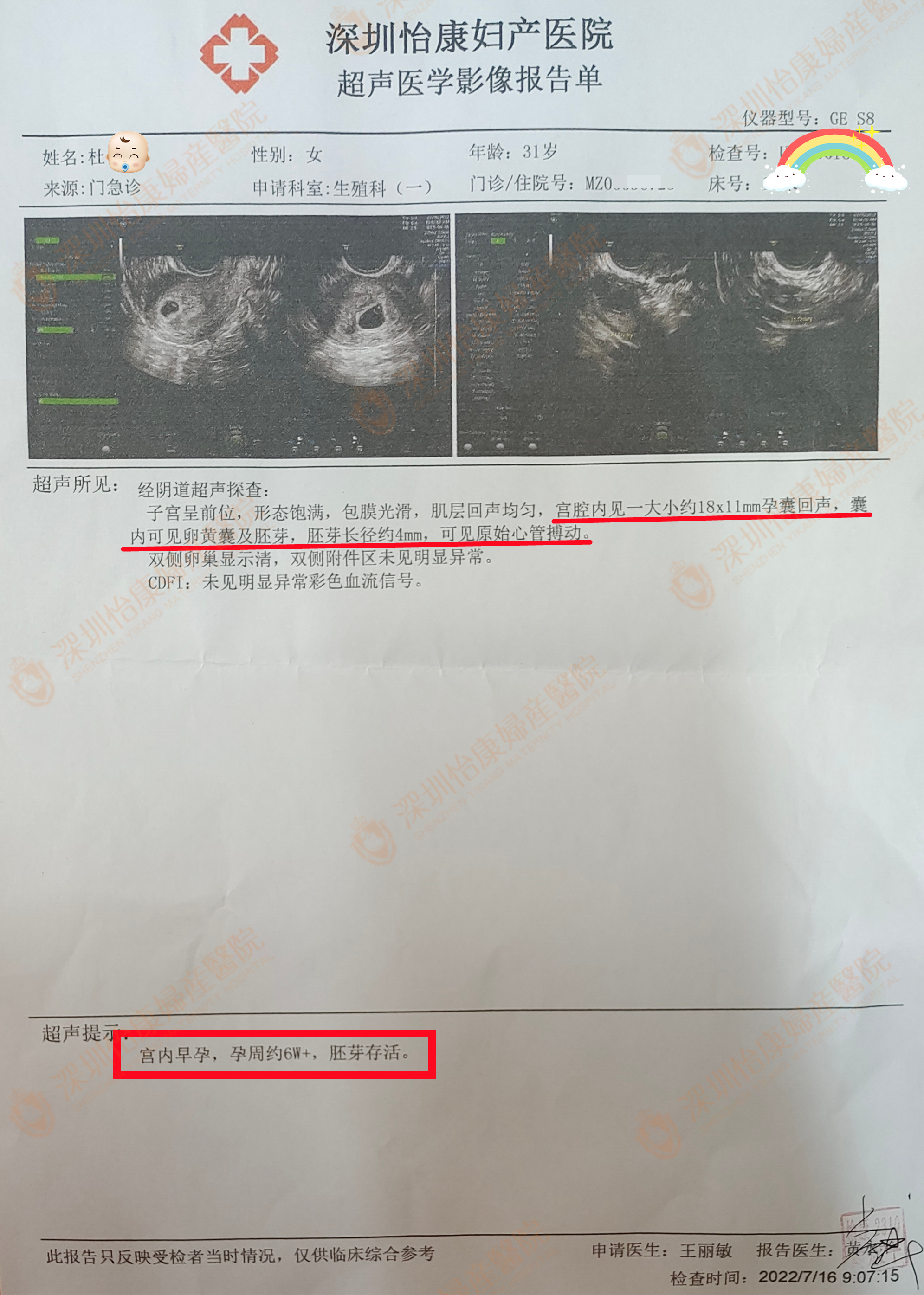 外院看诊3年多未果准备试管 来怡康找到并解决问题孕6周
