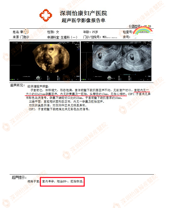 辗转多家医院胎停3次不敢怀 怡康专家助她进入稳定孕8周