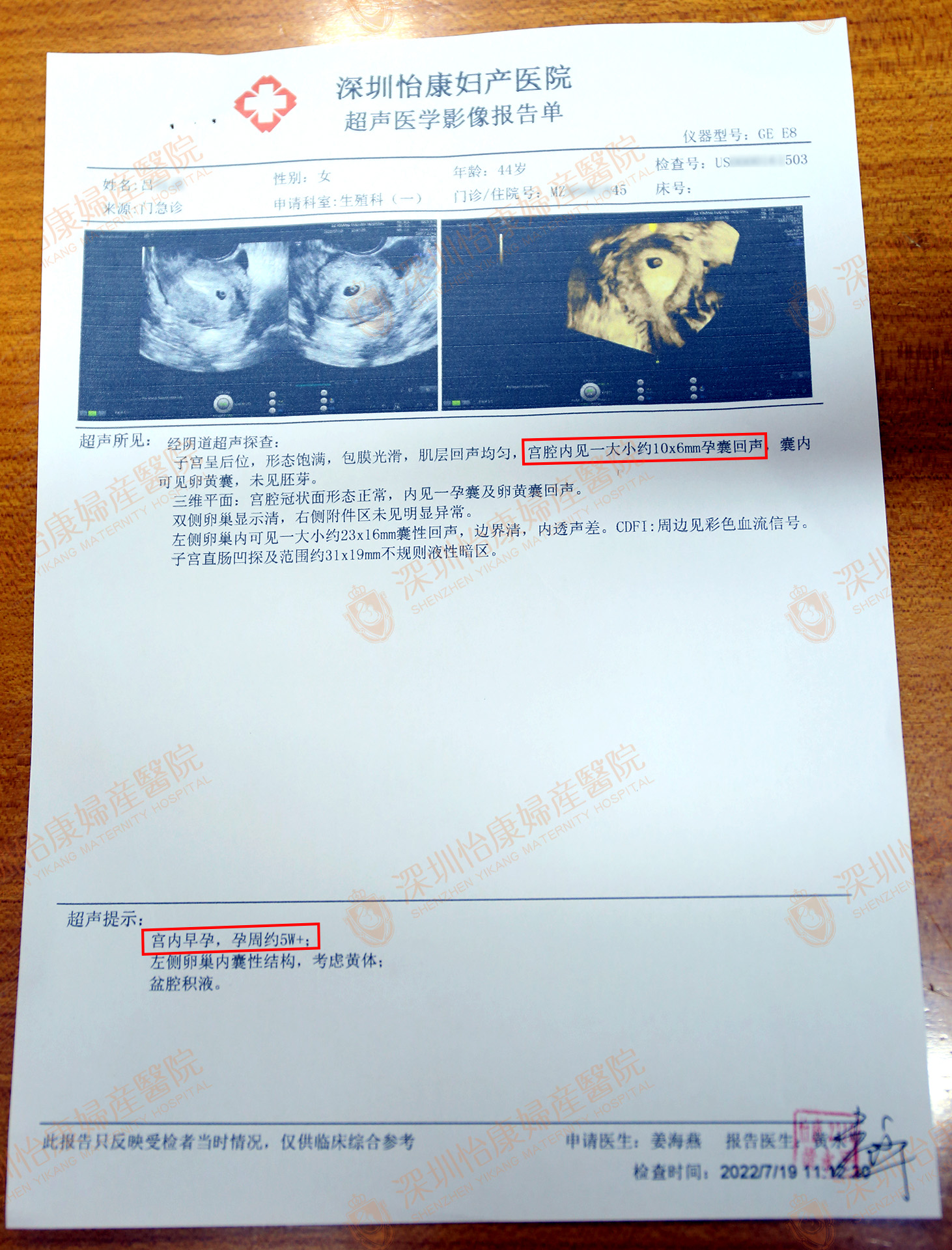 求孕十年辛苦怡康一朝圆梦 44岁高龄+单侧输卵管成功宫内怀孕