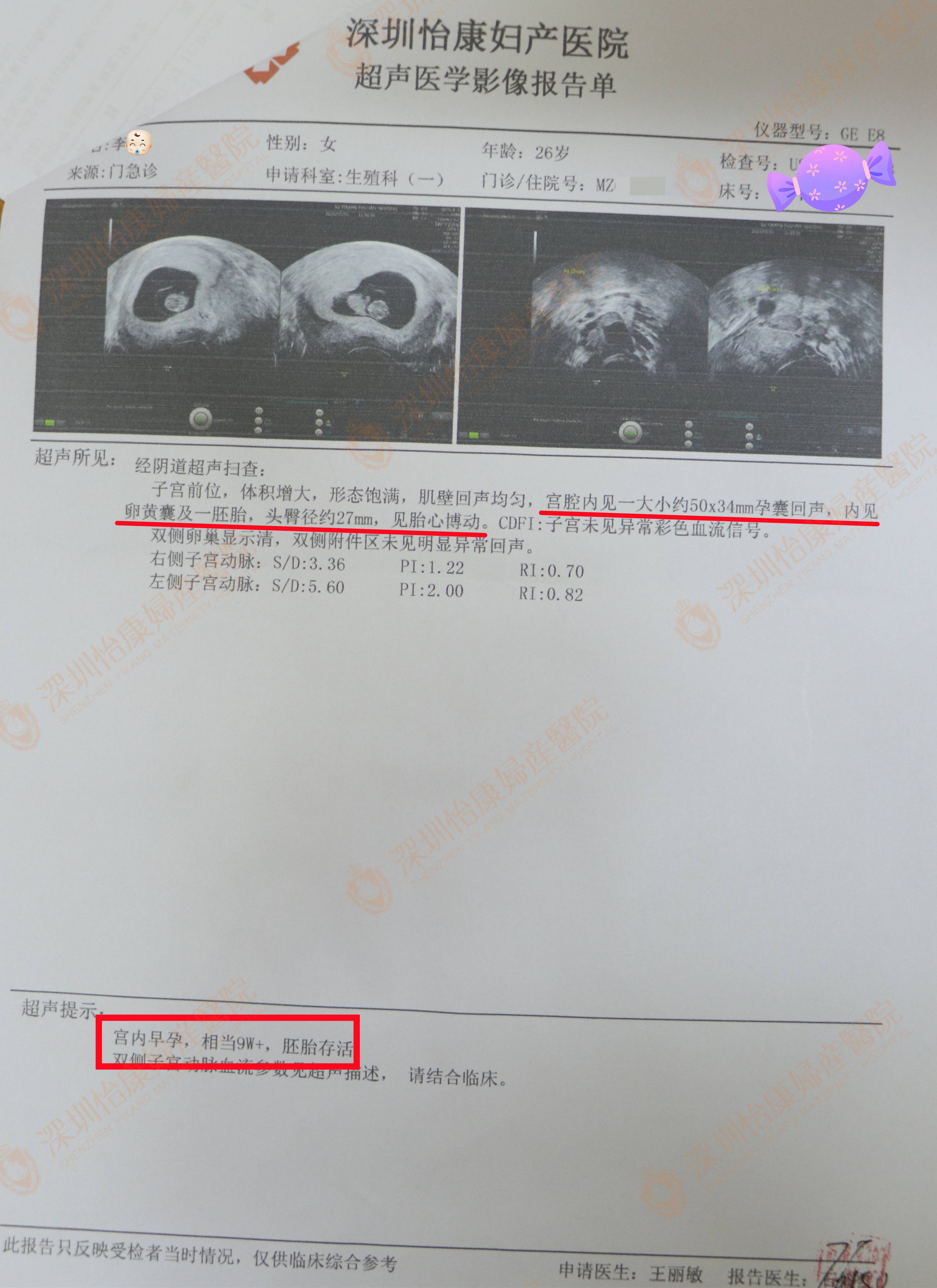 外院治疗无效开朗的她变郁闷 从江西赶到怡康专家助她好孕