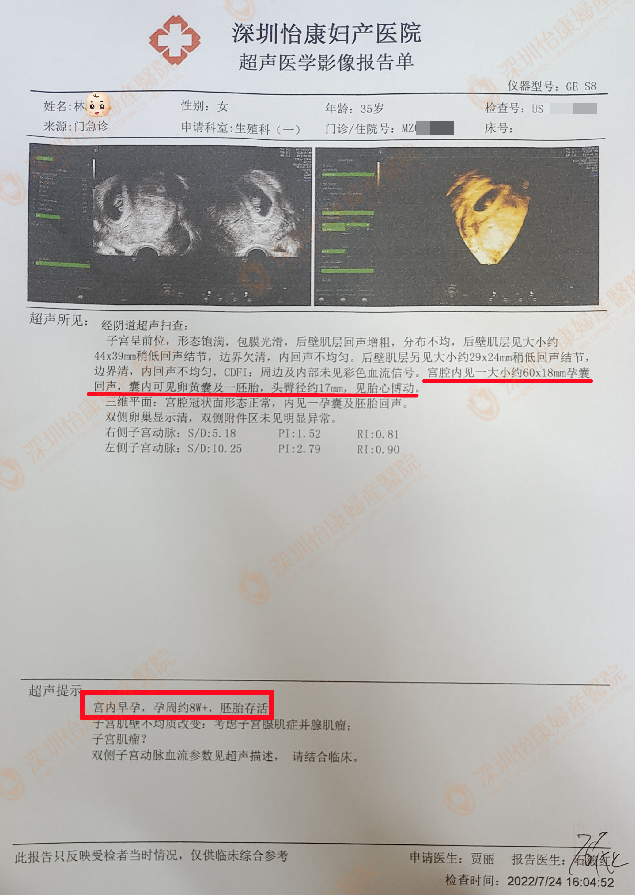 求孕10年未果朋友介绍来怡康 情况复杂专家联合助她喜怀孕