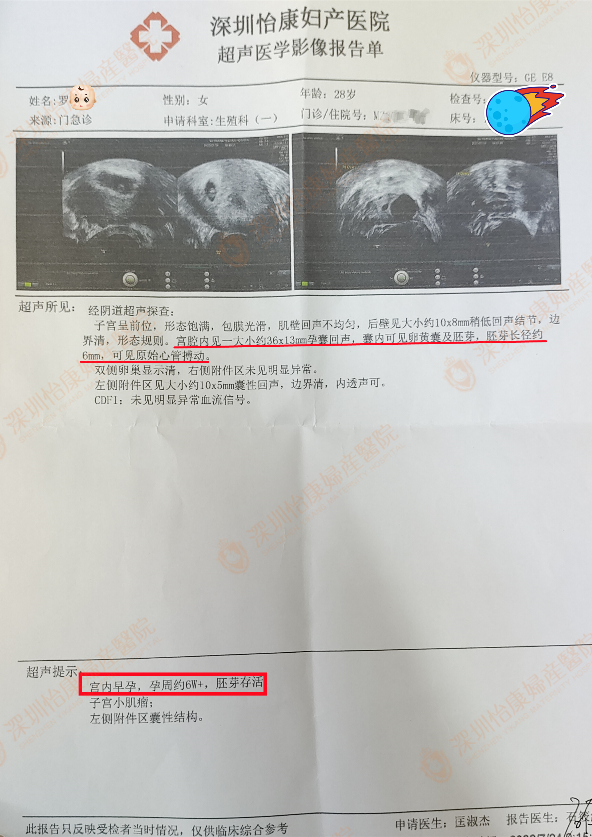 5年多未孕外院治疗无效成了心结 来怡康术后2个月恩爱夫妻终圆梦