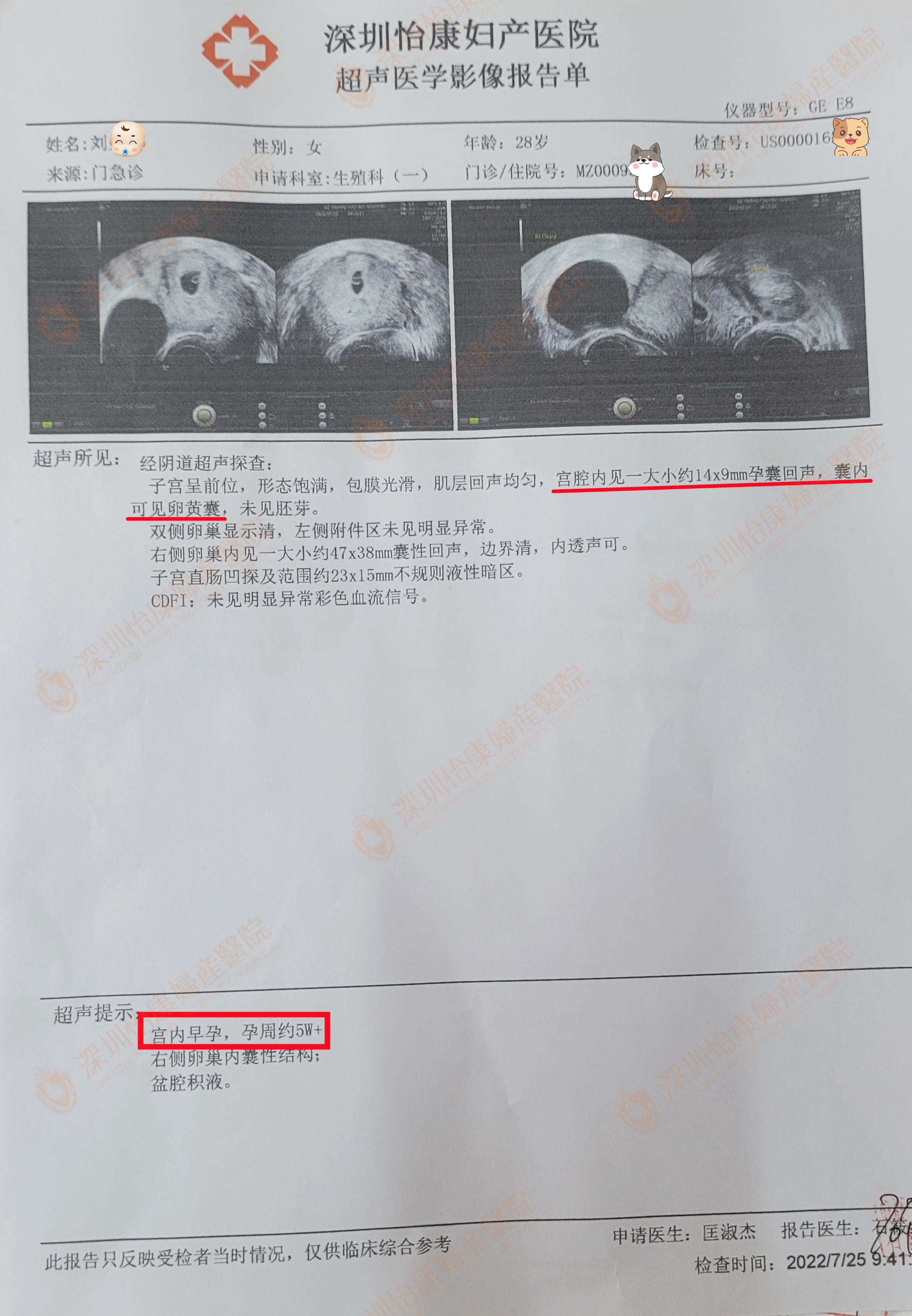 不孕来怡康被服务打动 保守治疗获1个月快孕