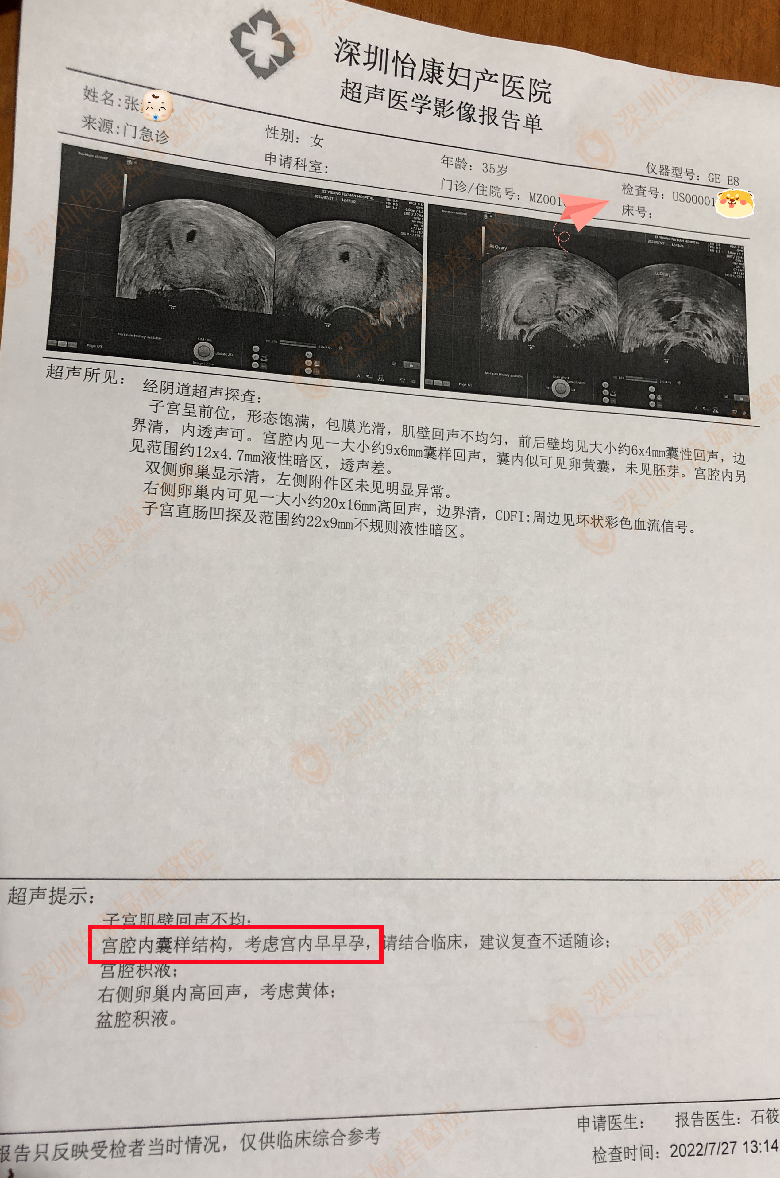 怡康指导科学备孕 喜获宫内早早孕