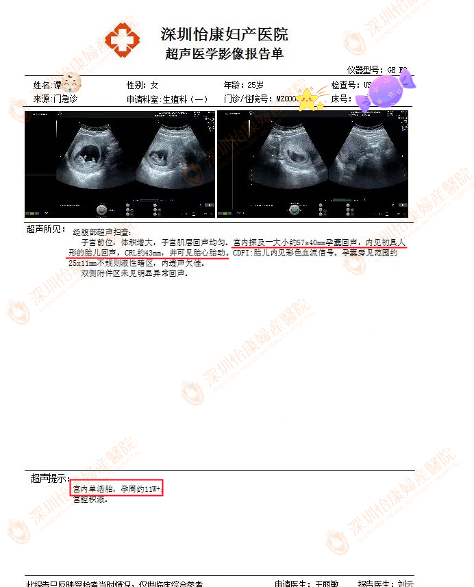 已孕11周+  B超大致能看到宝宝样子了