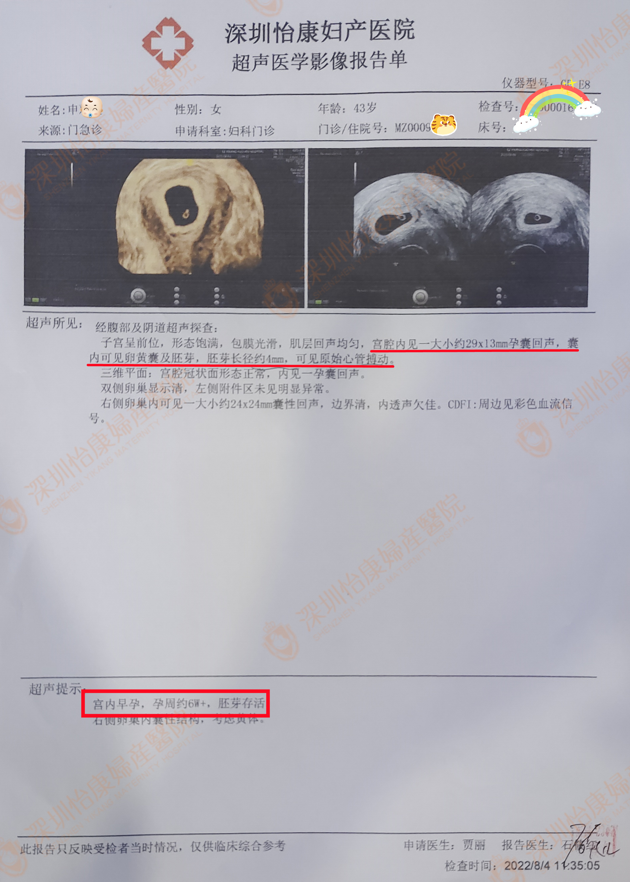 结扎20年选择来怡康求孕 高龄的她以乐观心态迎快孕