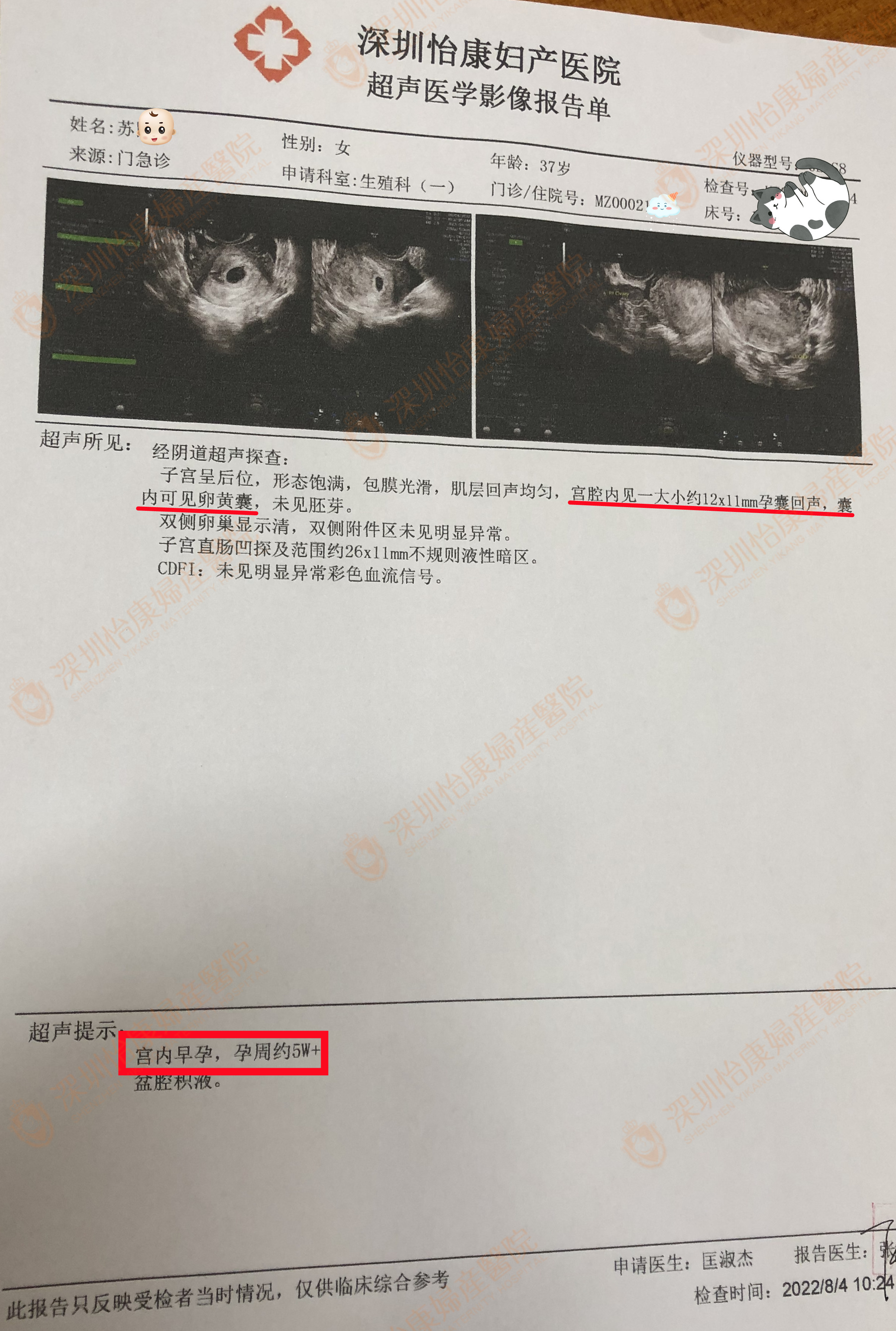 不良孕史+备孕未果内心忐忑 医生努力+家属配合收获好孕