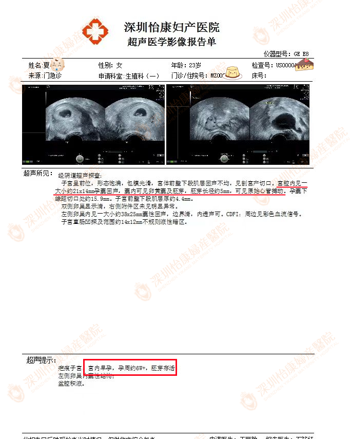 怡康专家精心呵护 两胎都是顺利快孕