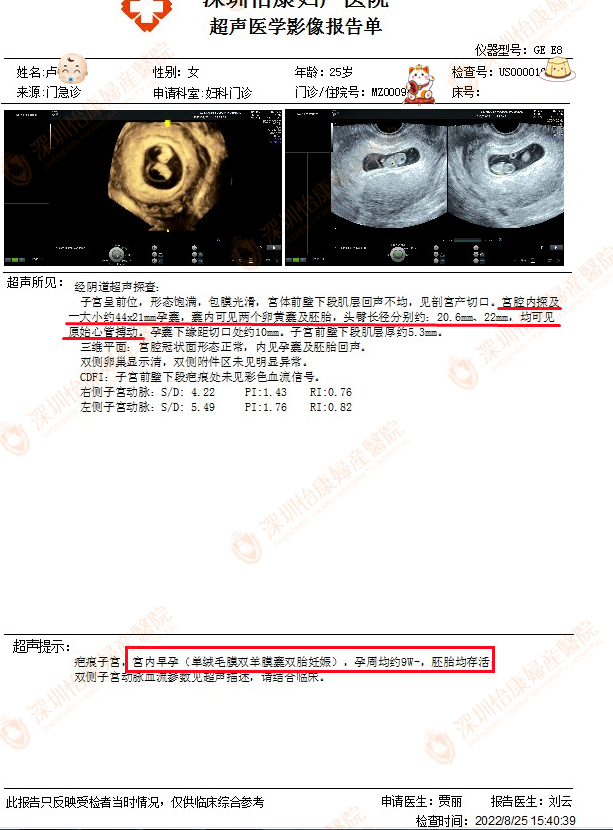 来怡康备孕三孩 成功怀上双胞胎