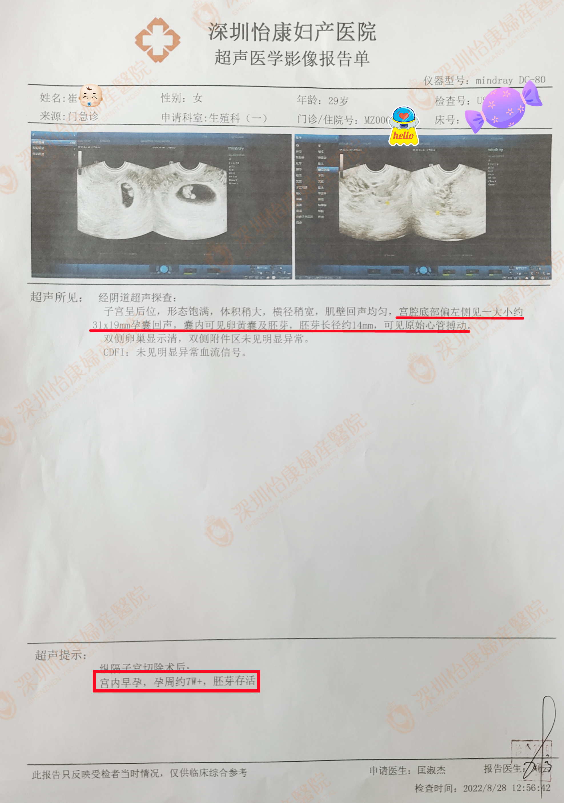 耐心专家温柔患者一起配合 身体治疗心理抚慰共迎喜讯