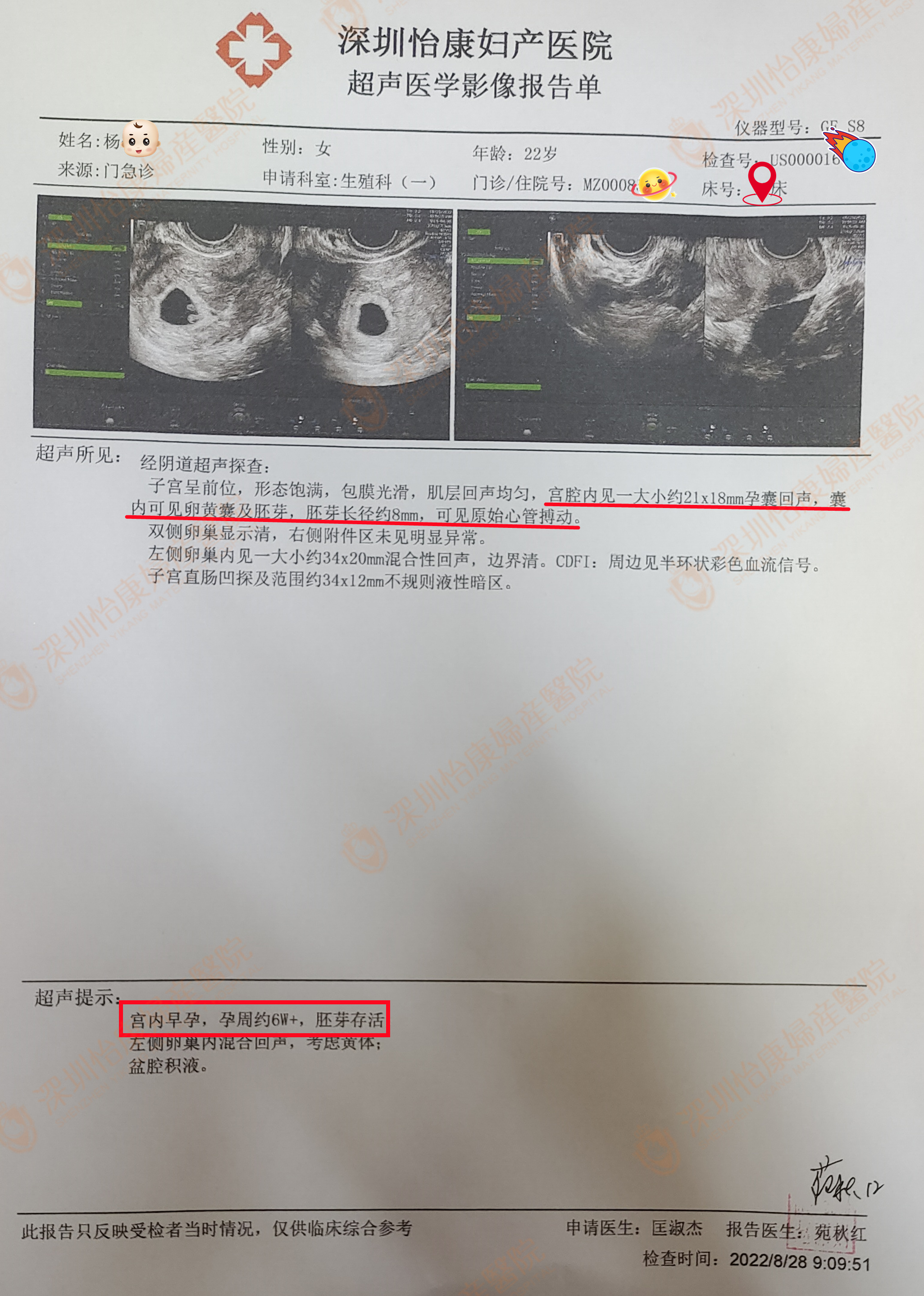 惊险！外院误诊宫外孕差点打胎 给力！怡康专家来护航力挽狂澜