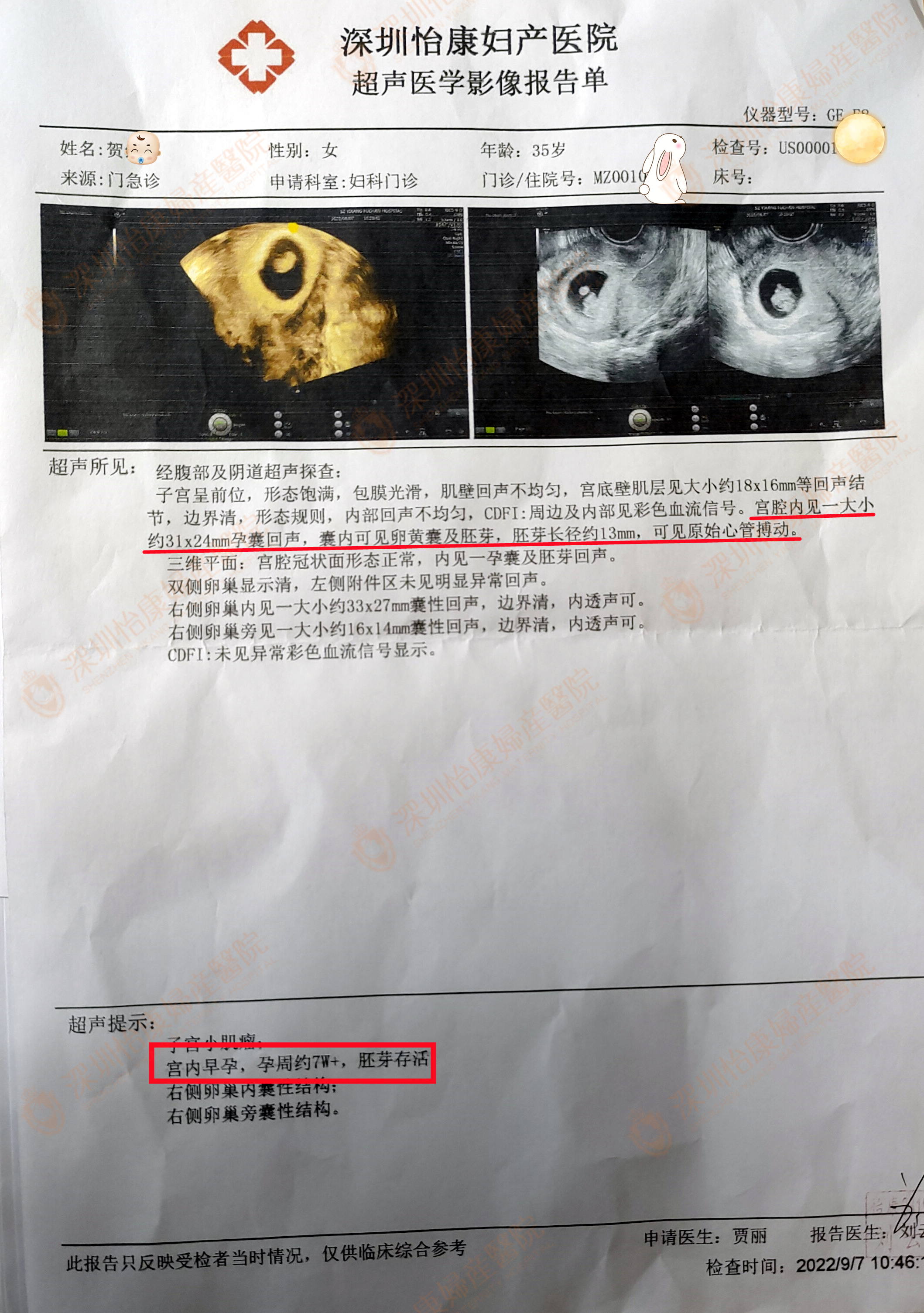 3次不良妊娠身心俱疲 专家关怀施治2月快孕