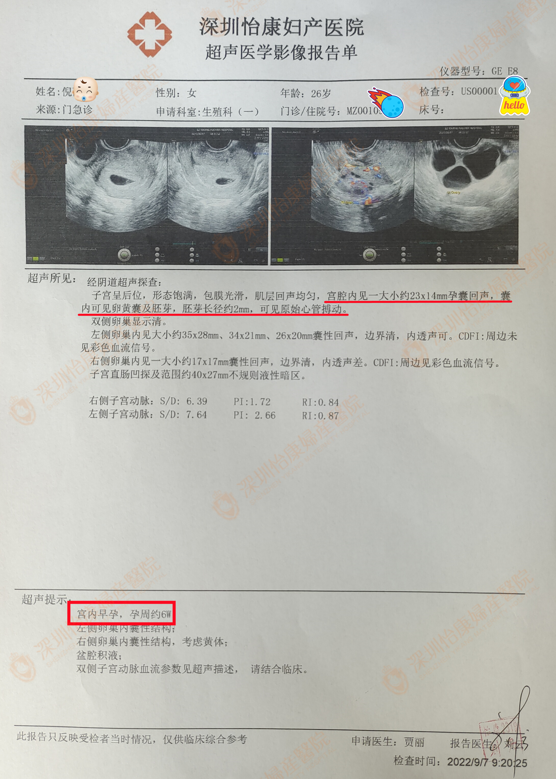 面临催生求助怡康 医患配合两月快孕