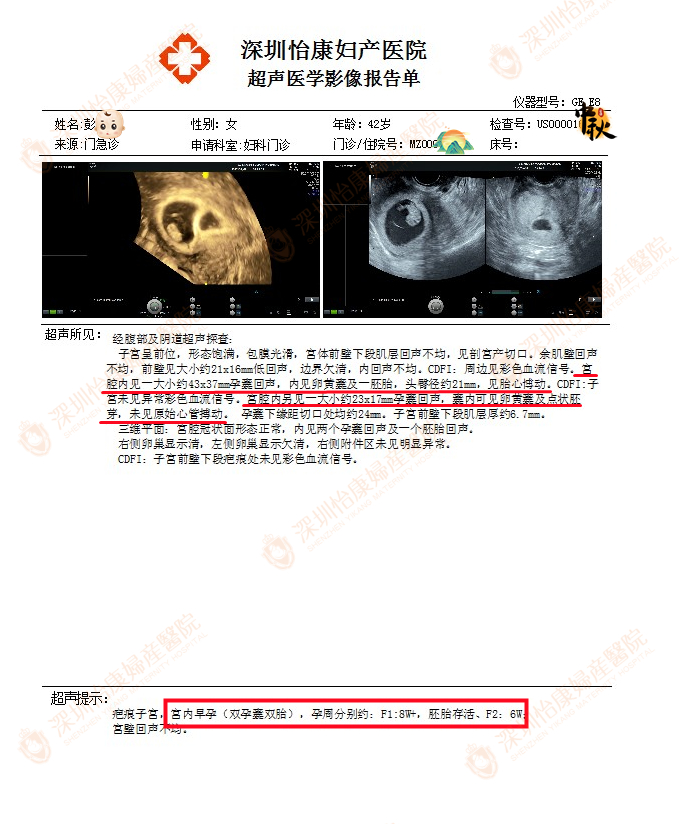 专家建议做针对性检查 高龄喜怀双胎护航继续