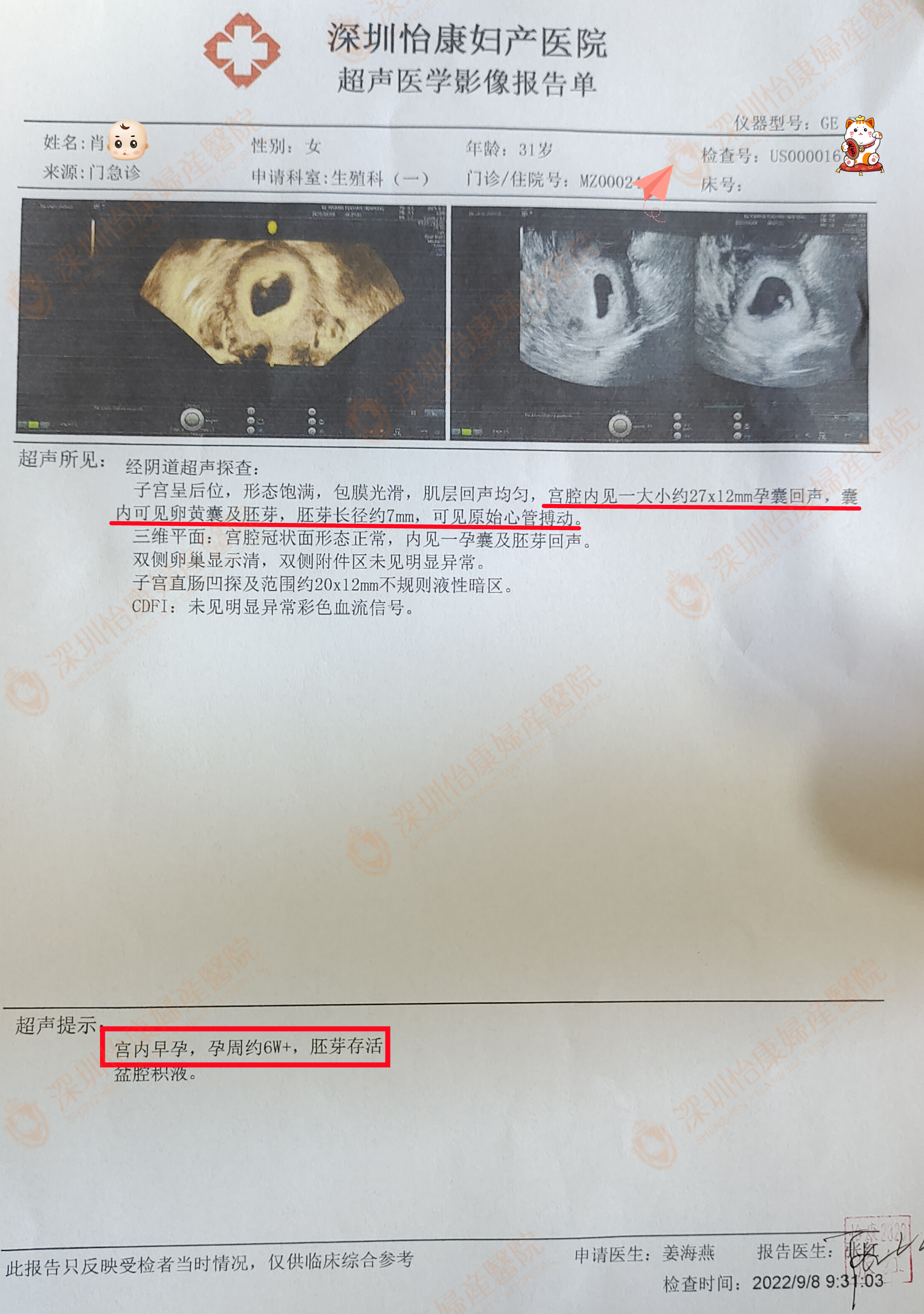 一胎在这儿怀 二胎还来~