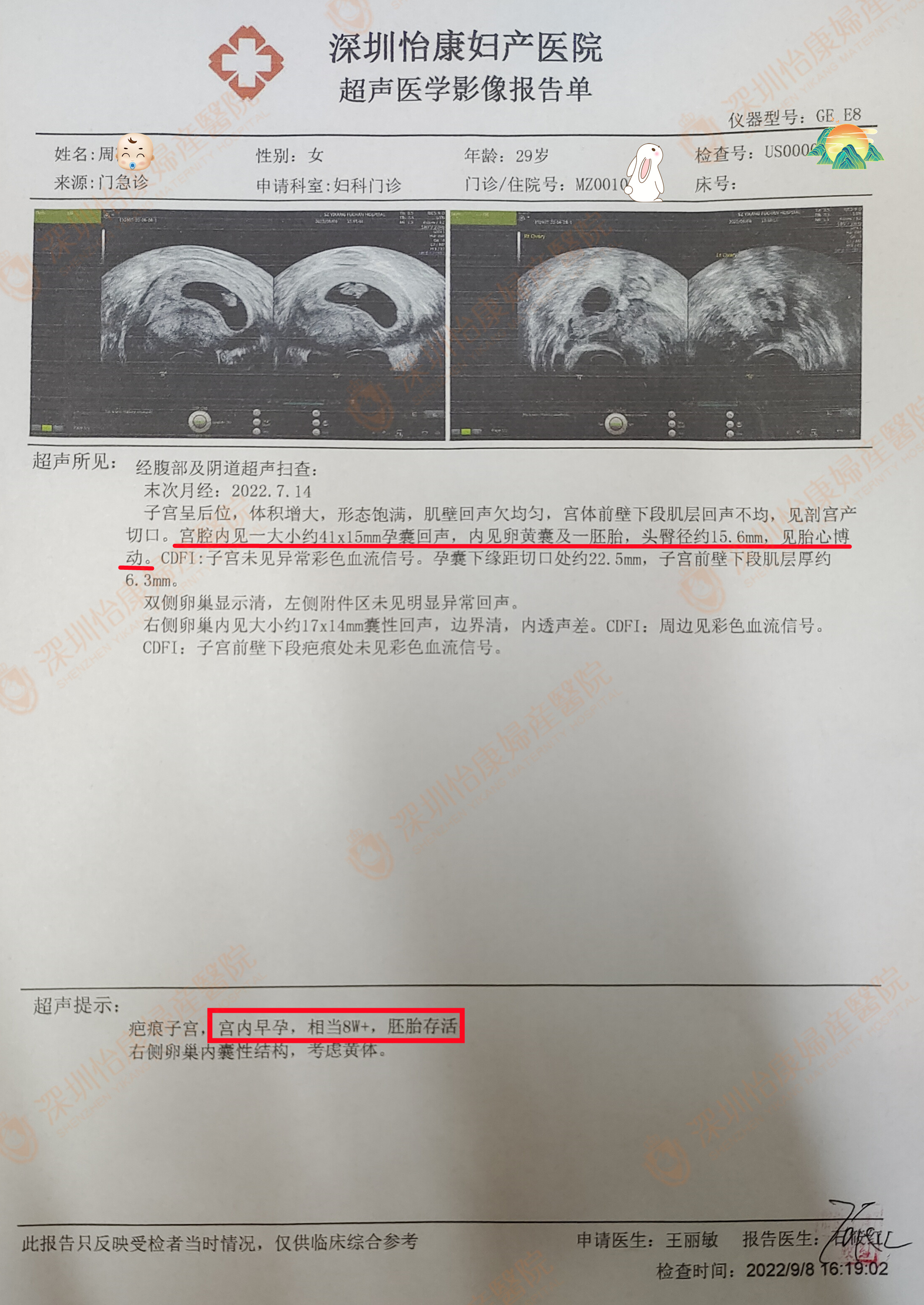 科学备孕找怡康 专家助她迎好孕