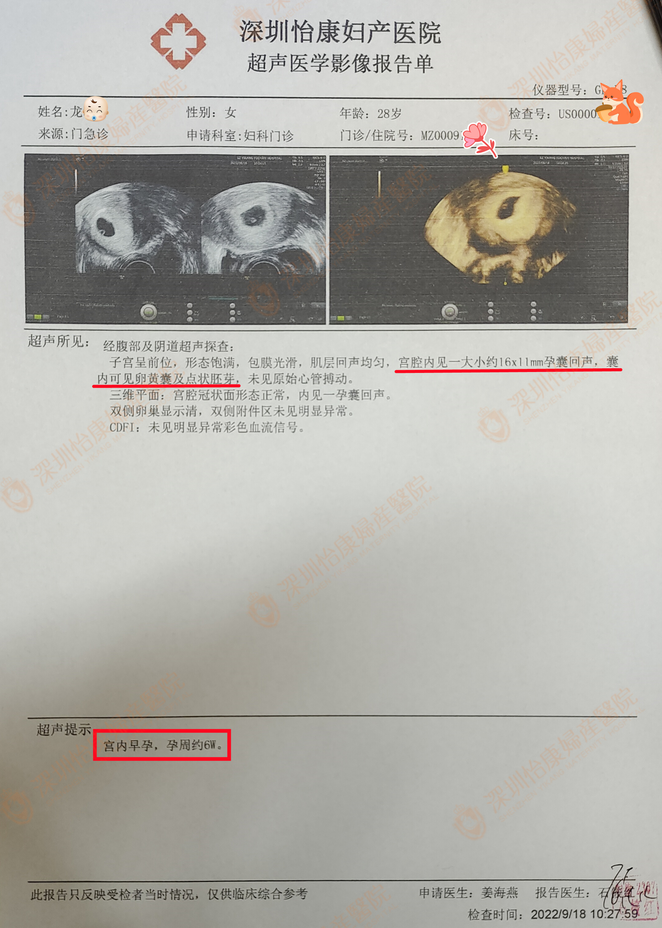 备孕3年未果直奔怡康 已孕6周+携手发喜糖