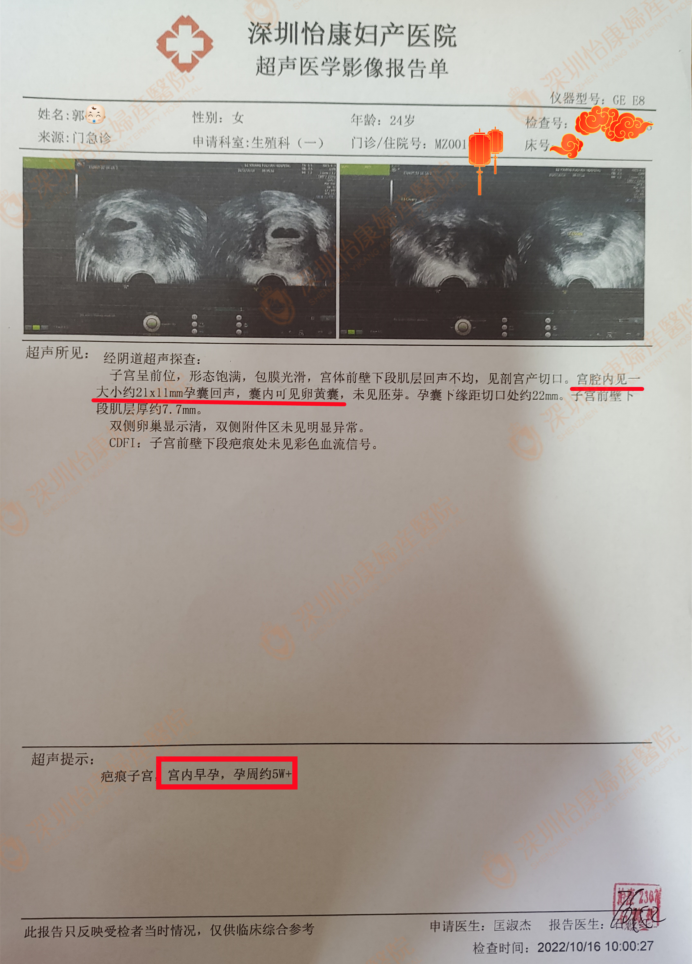久备不孕直接求助怡康  术后2月快孕迎来表白