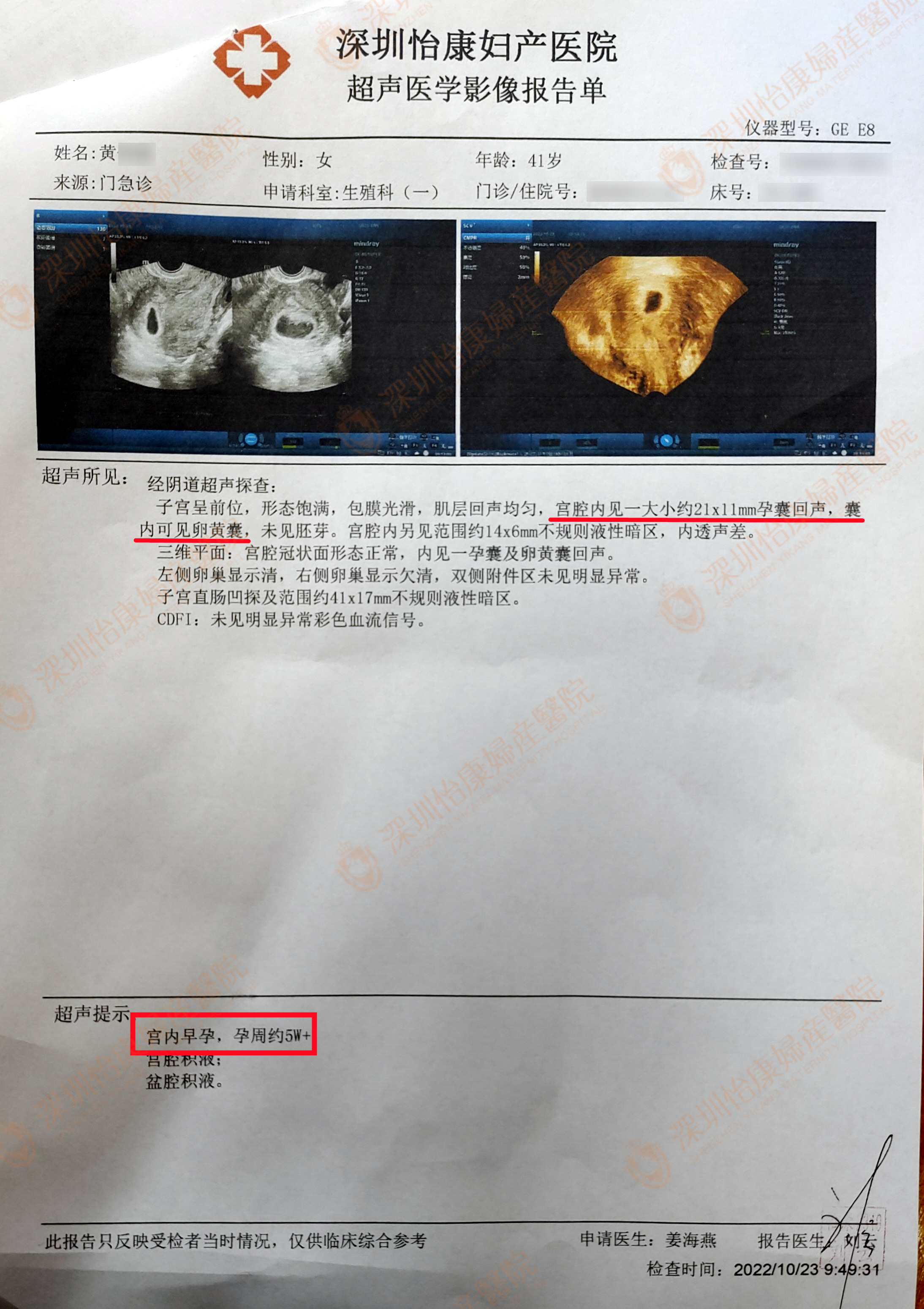结扎16年，在怡康复通3个月后怀孕！